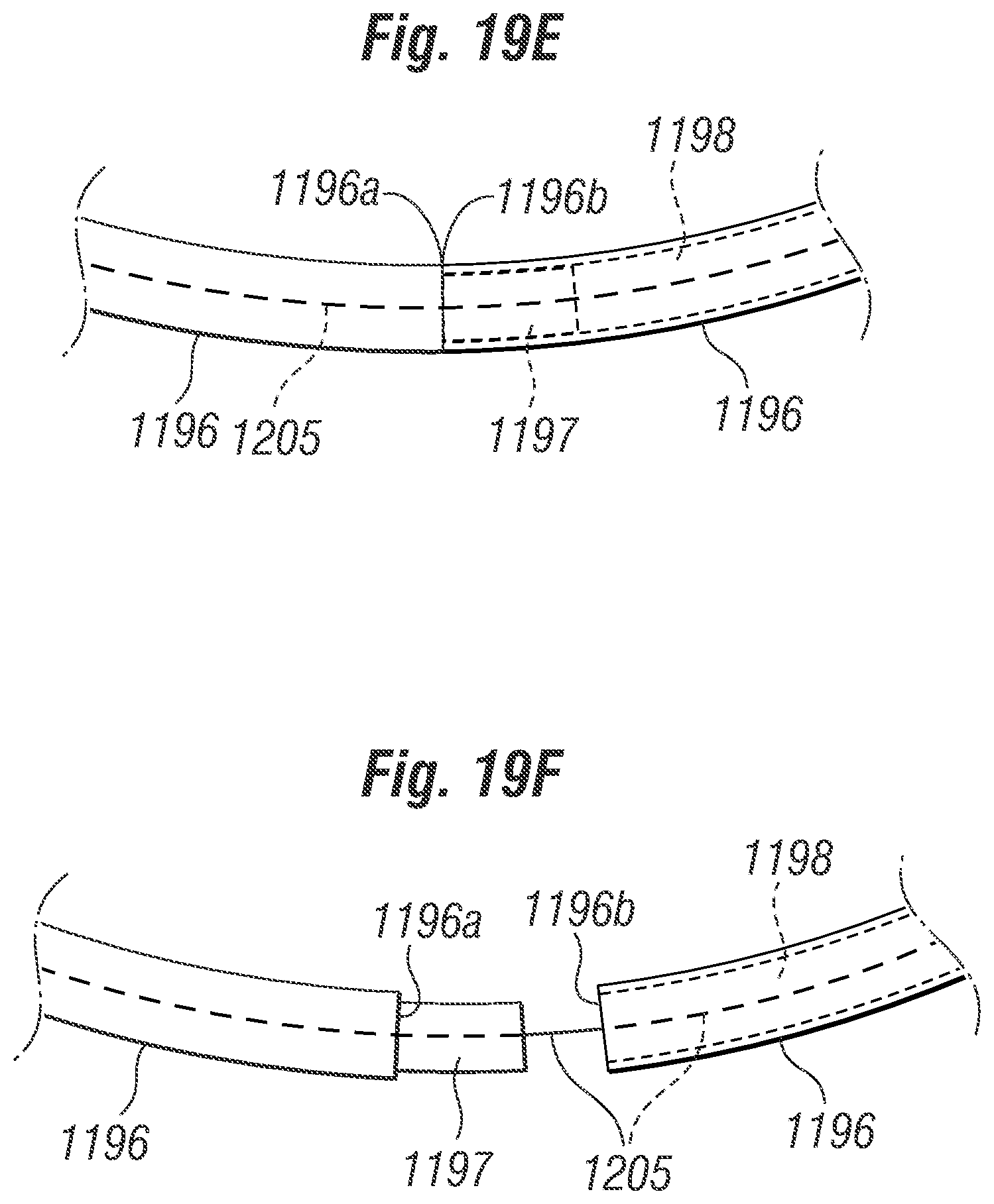 Patent US12396846 Figure 19 – Methods of implanting a prosthetic heart valve within another