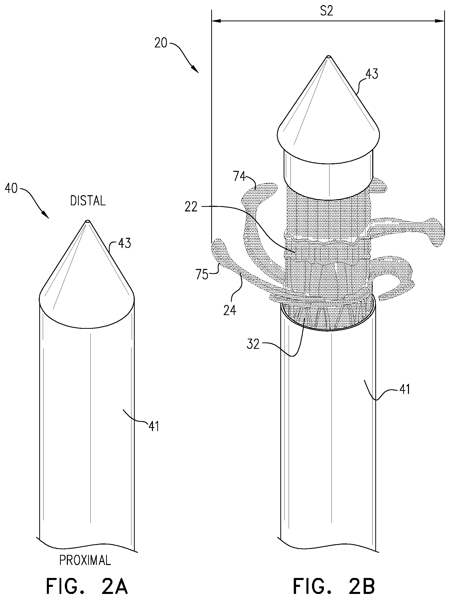 Patent US12396847 Figure 4 – Atrioventricular valve replacement