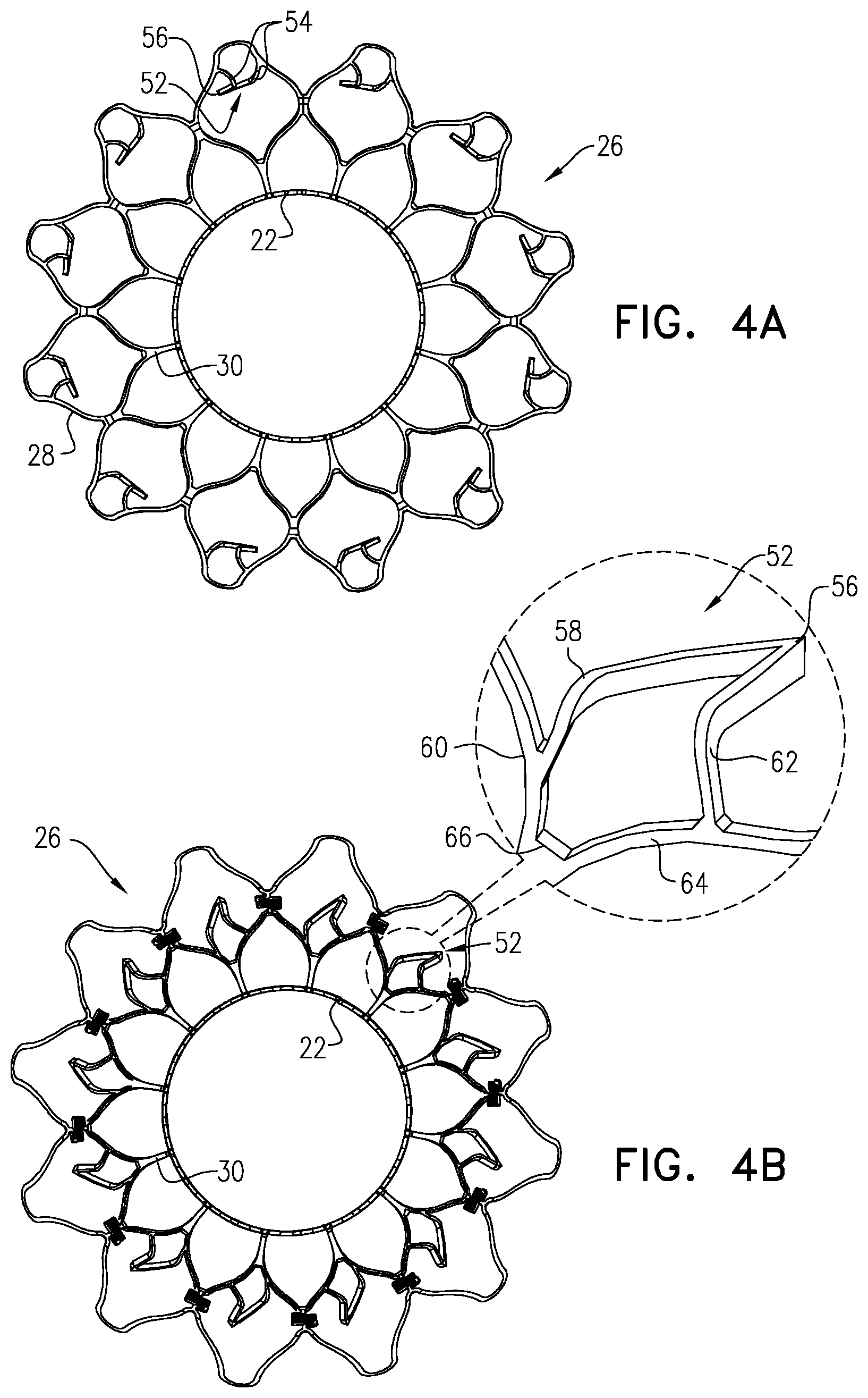 Patent US12396847 Figure 6 – Atrioventricular valve replacement
