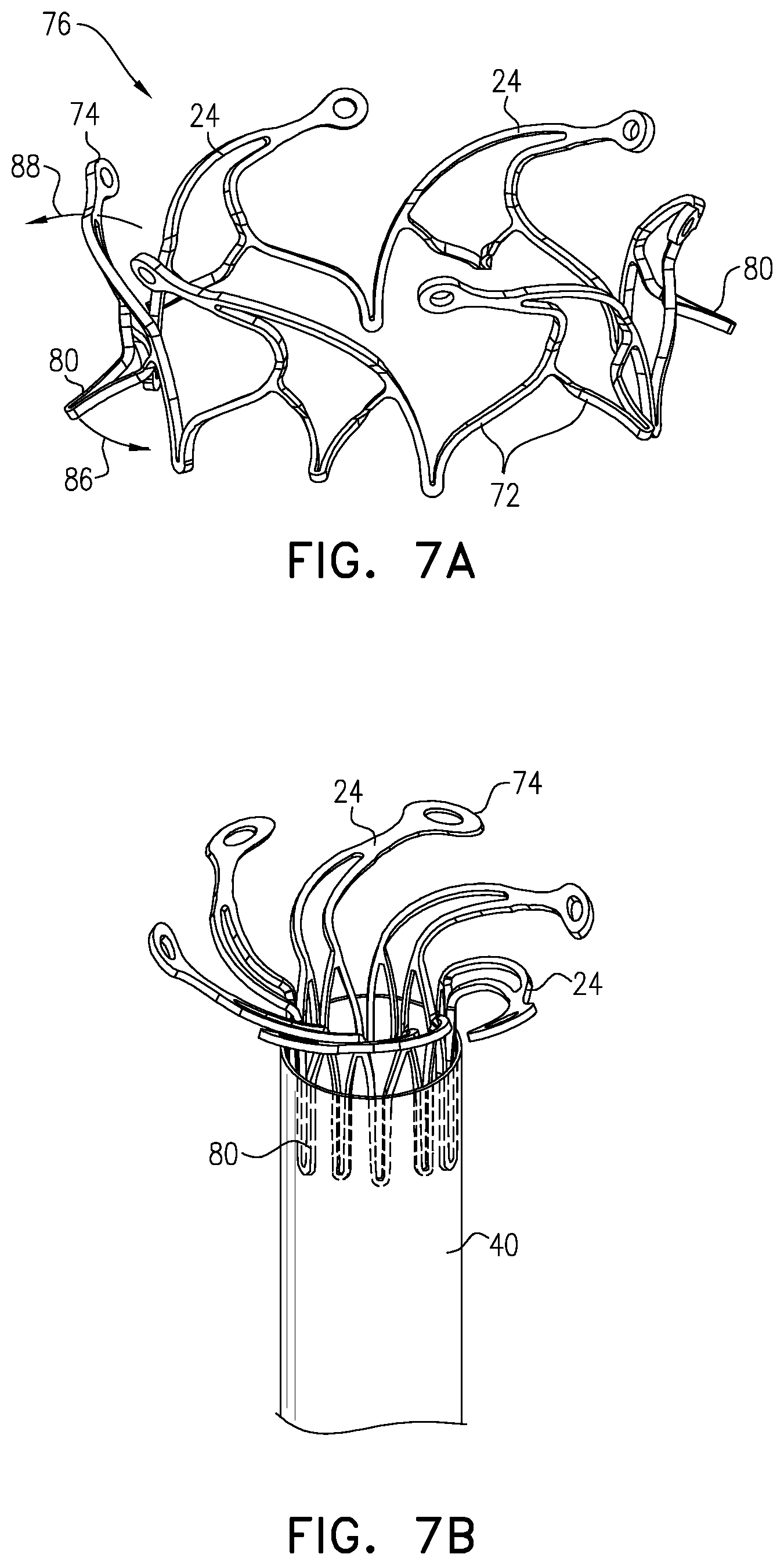 Patent US12396847 Figure 9 – Atrioventricular valve replacement