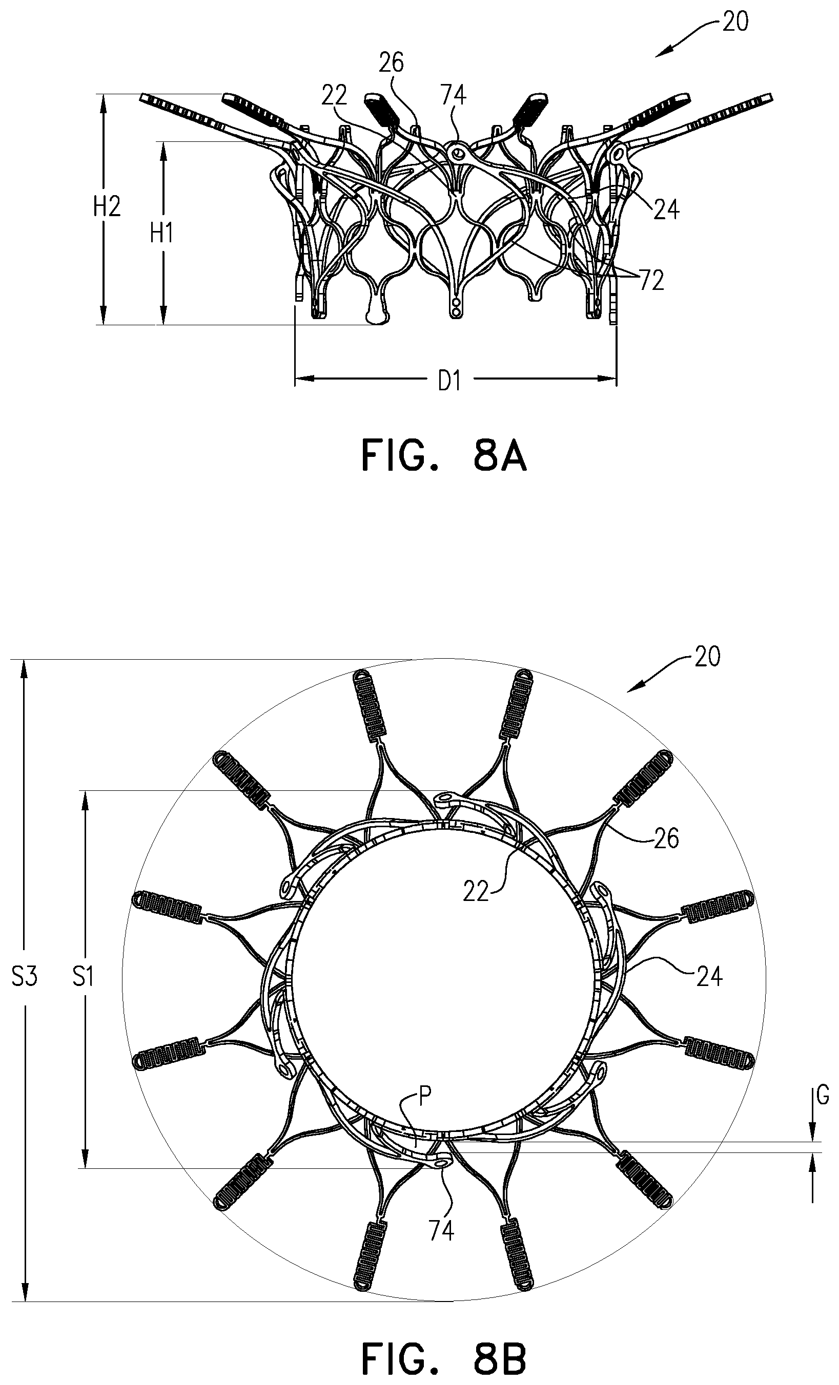 Patent US12396847 Figure 10 – Atrioventricular valve replacement