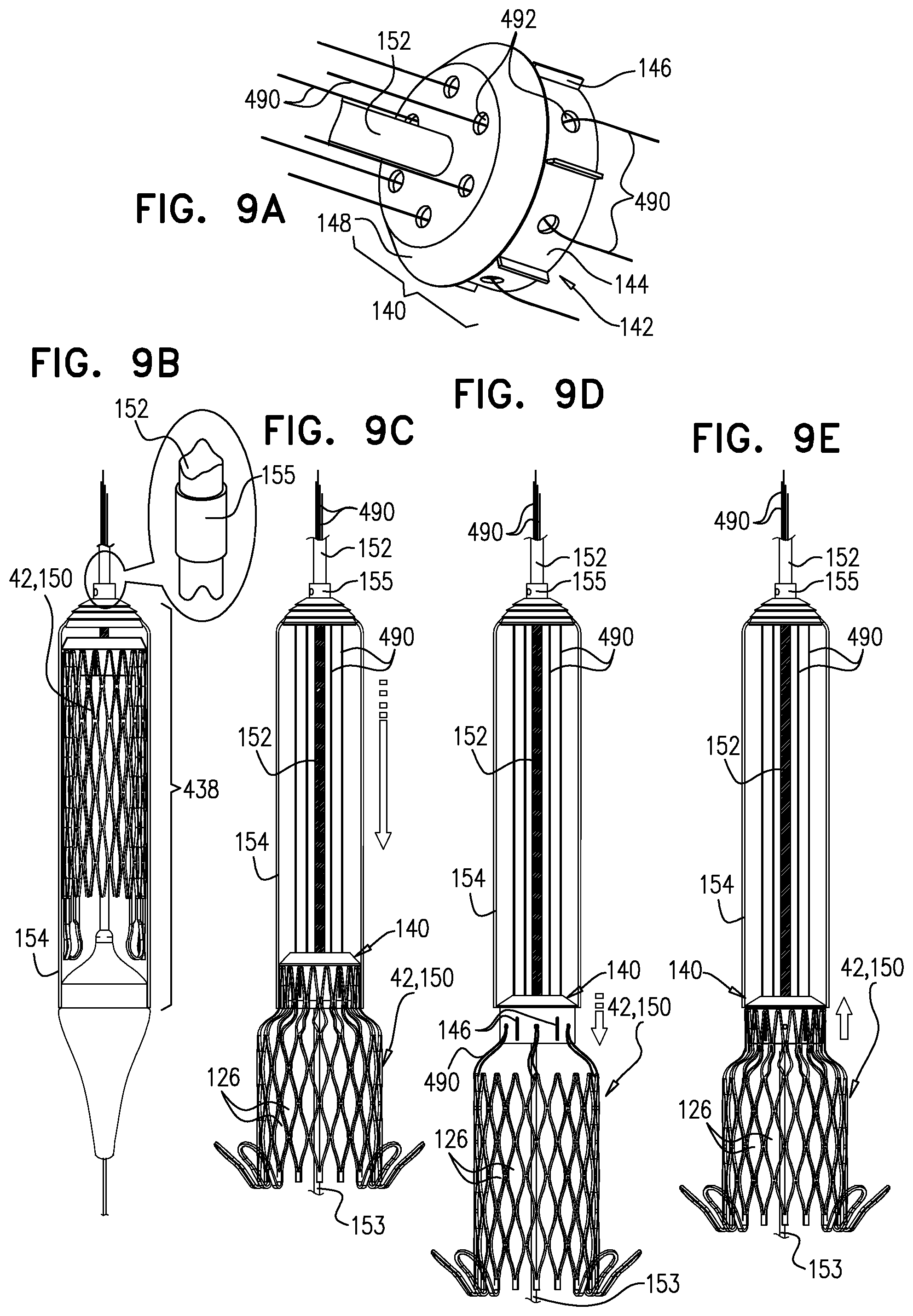 Patent US12396848 Figure 9 – Method for use at a heart valve