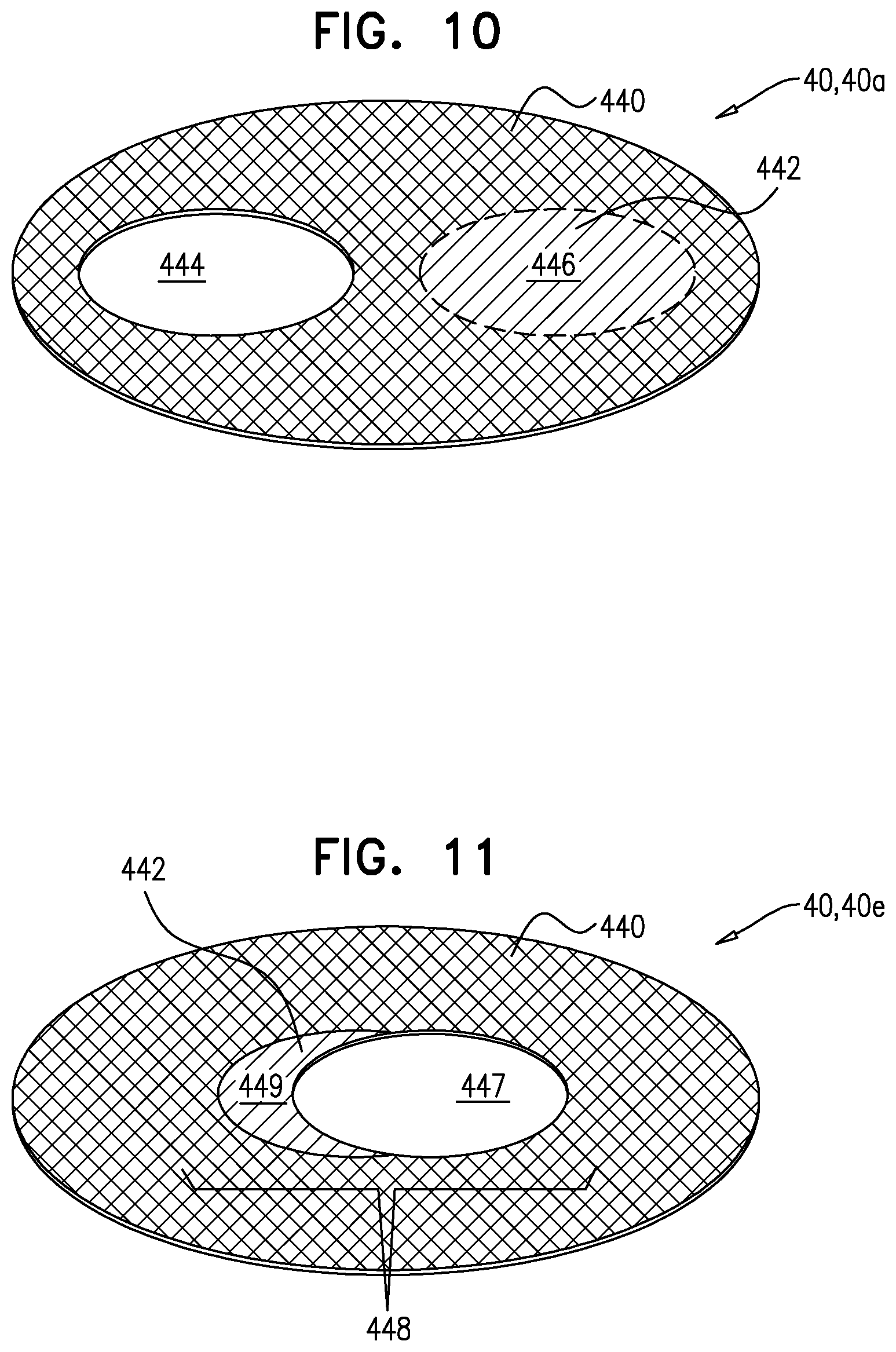 Patent US12396848 Figure 10 – Method for use at a heart valve