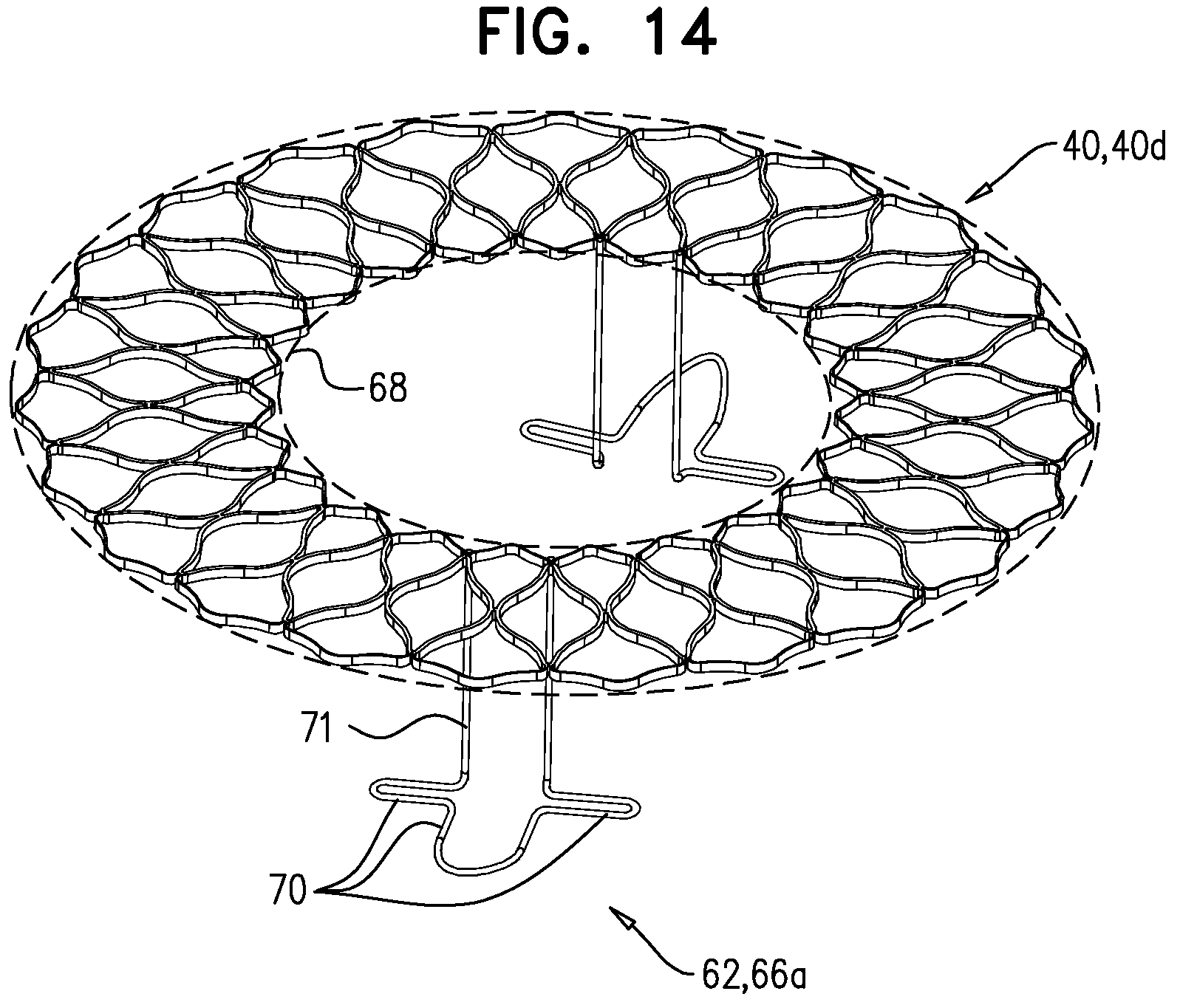 Patent US12396848 Figure 13 – Method for use at a heart valve