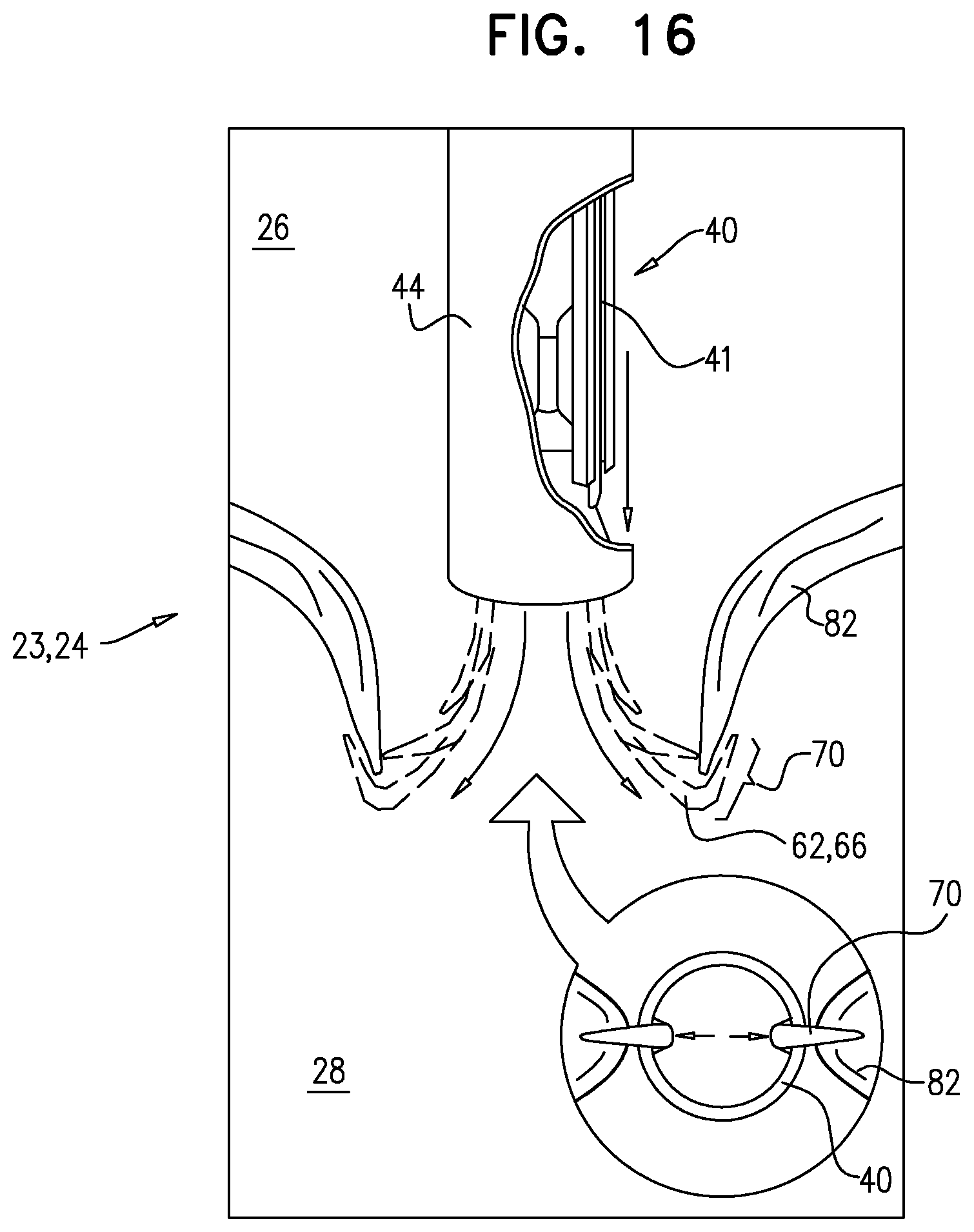 Patent US12396848 Figure 16 – Method for use at a heart valve