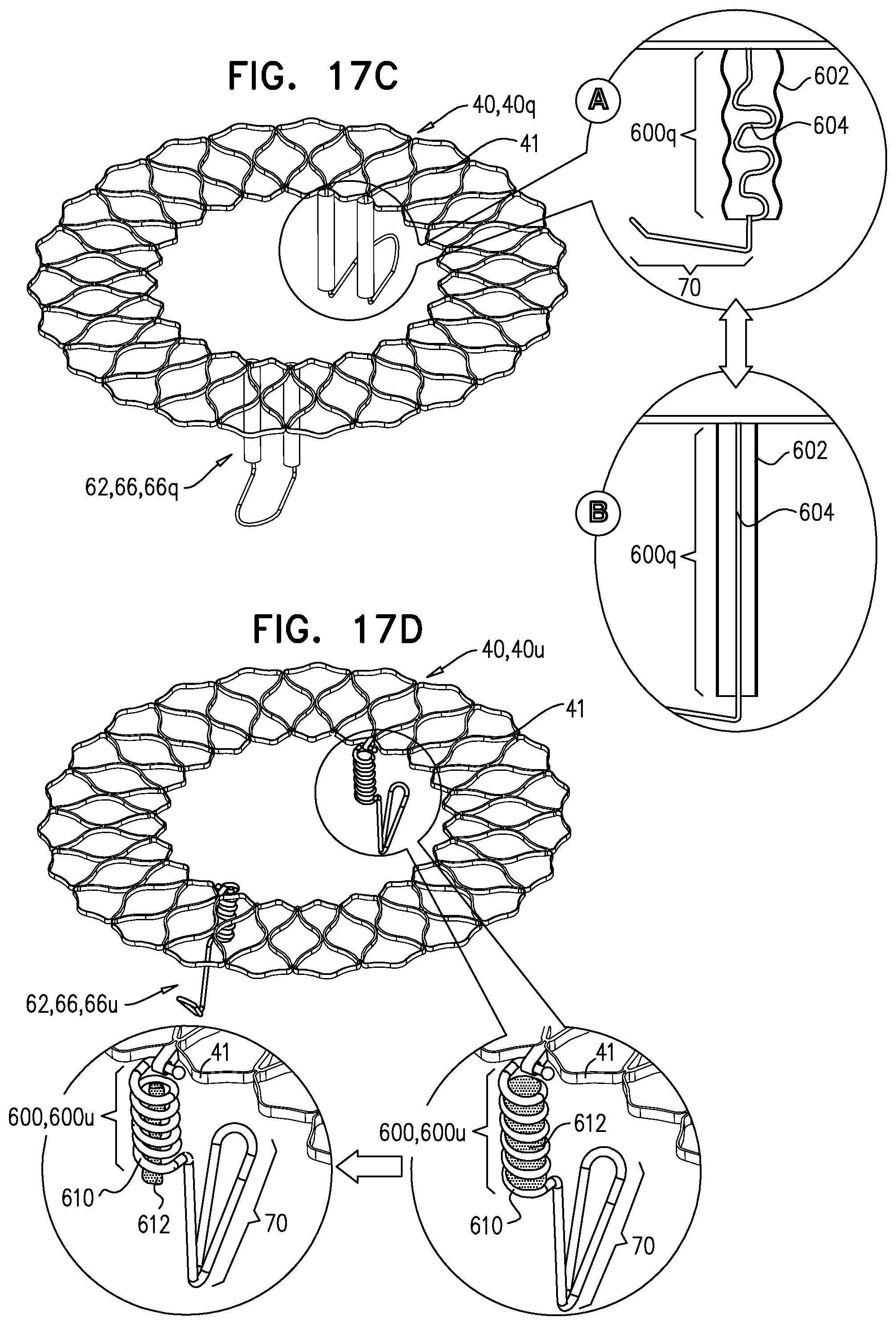 Patent US12396848 Figure 18 – Method for use at a heart valve