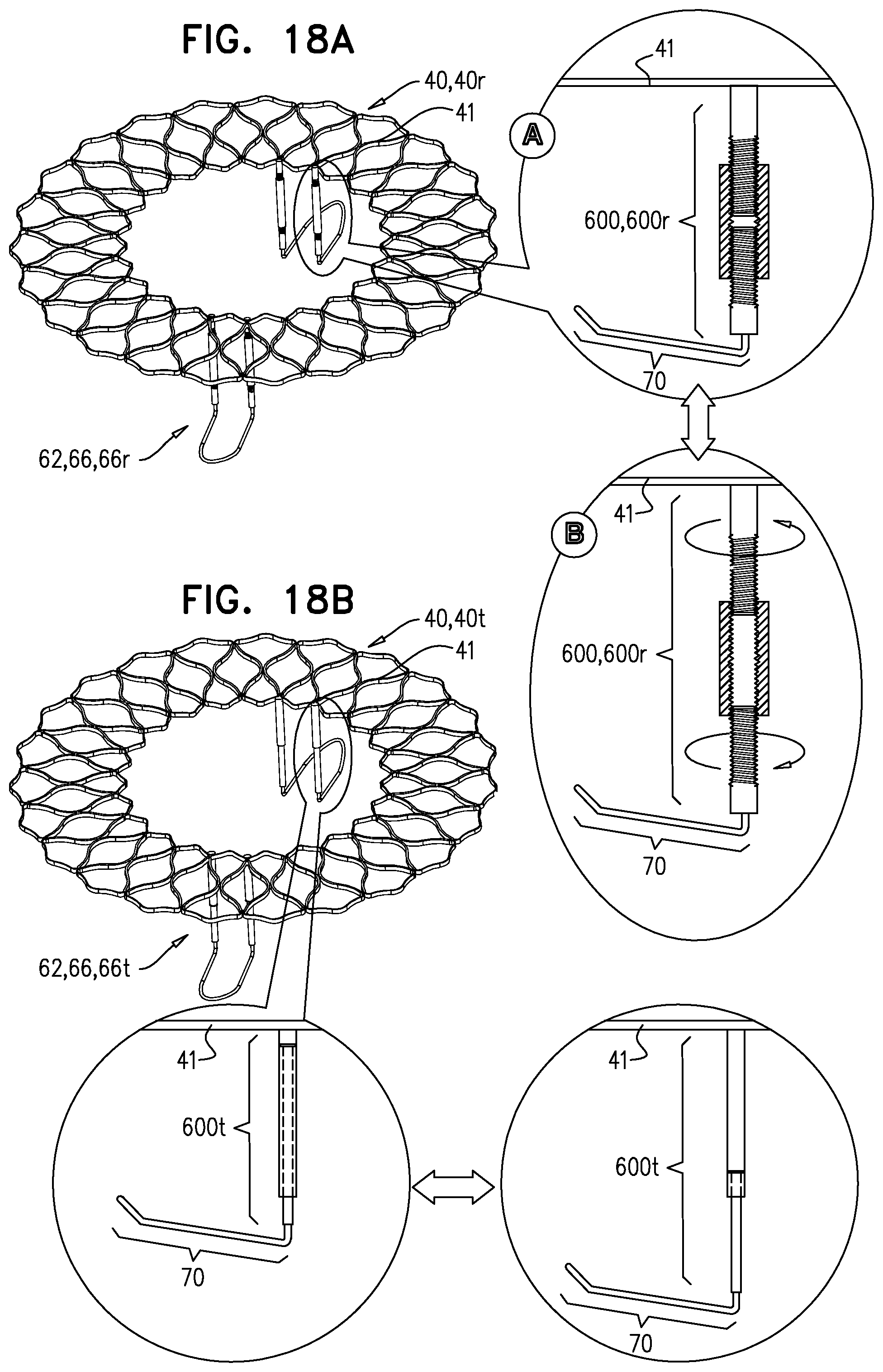 Patent US12396848 Figure 19 – Method for use at a heart valve