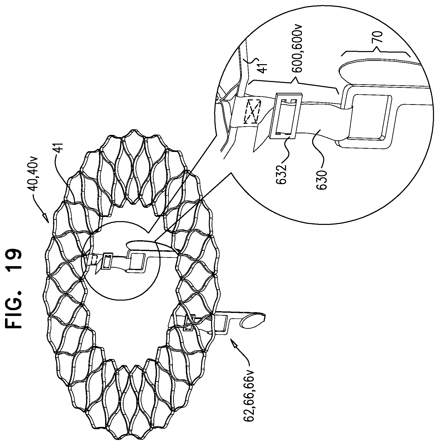 Patent US12396848 Figure 20 – Method for use at a heart valve