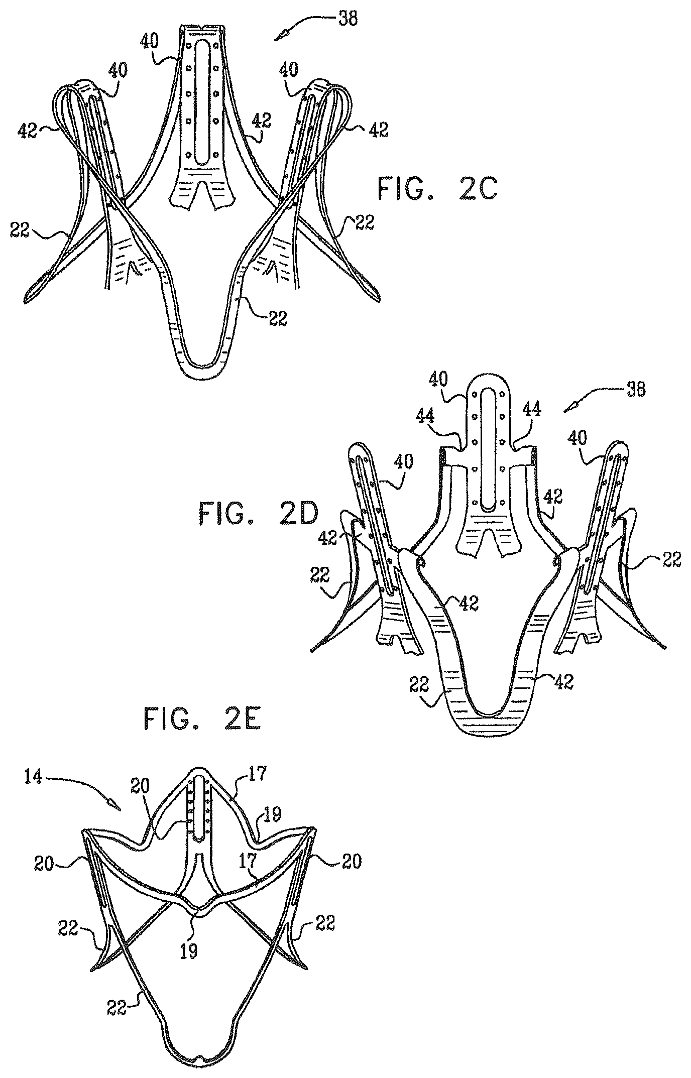 Patent US12396849 Figure 2 – Sinus-engaging valve fixation member