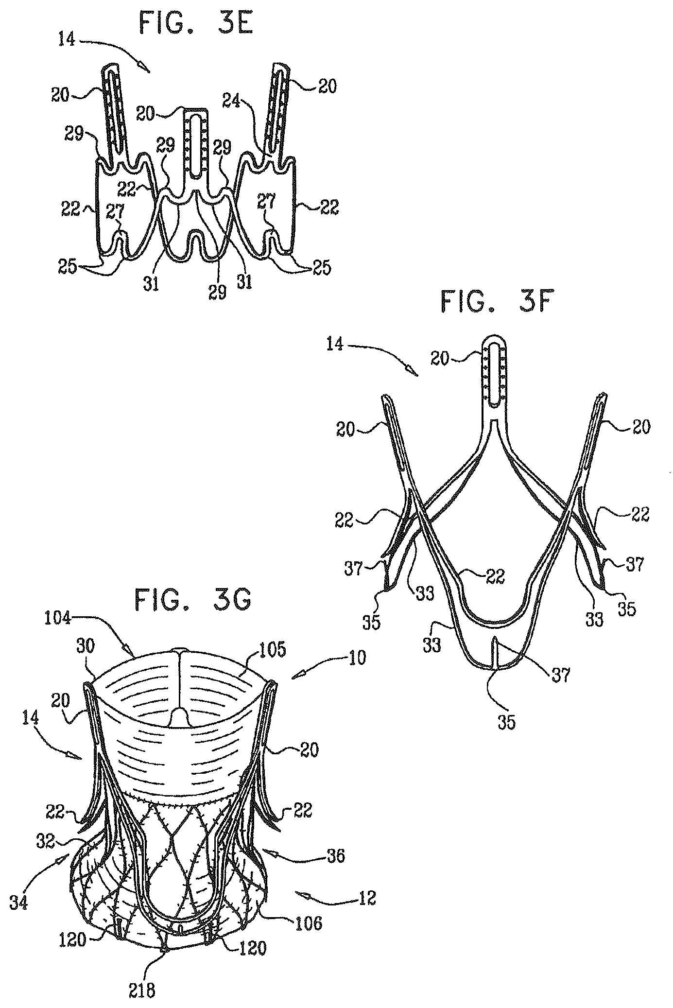 Patent US12396849 Figure 4 – Sinus-engaging valve fixation member