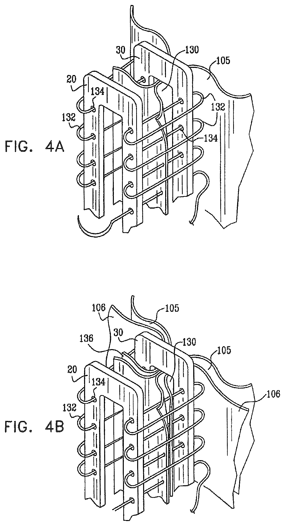 Patent US12396849 Figure 5 – Sinus-engaging valve fixation member