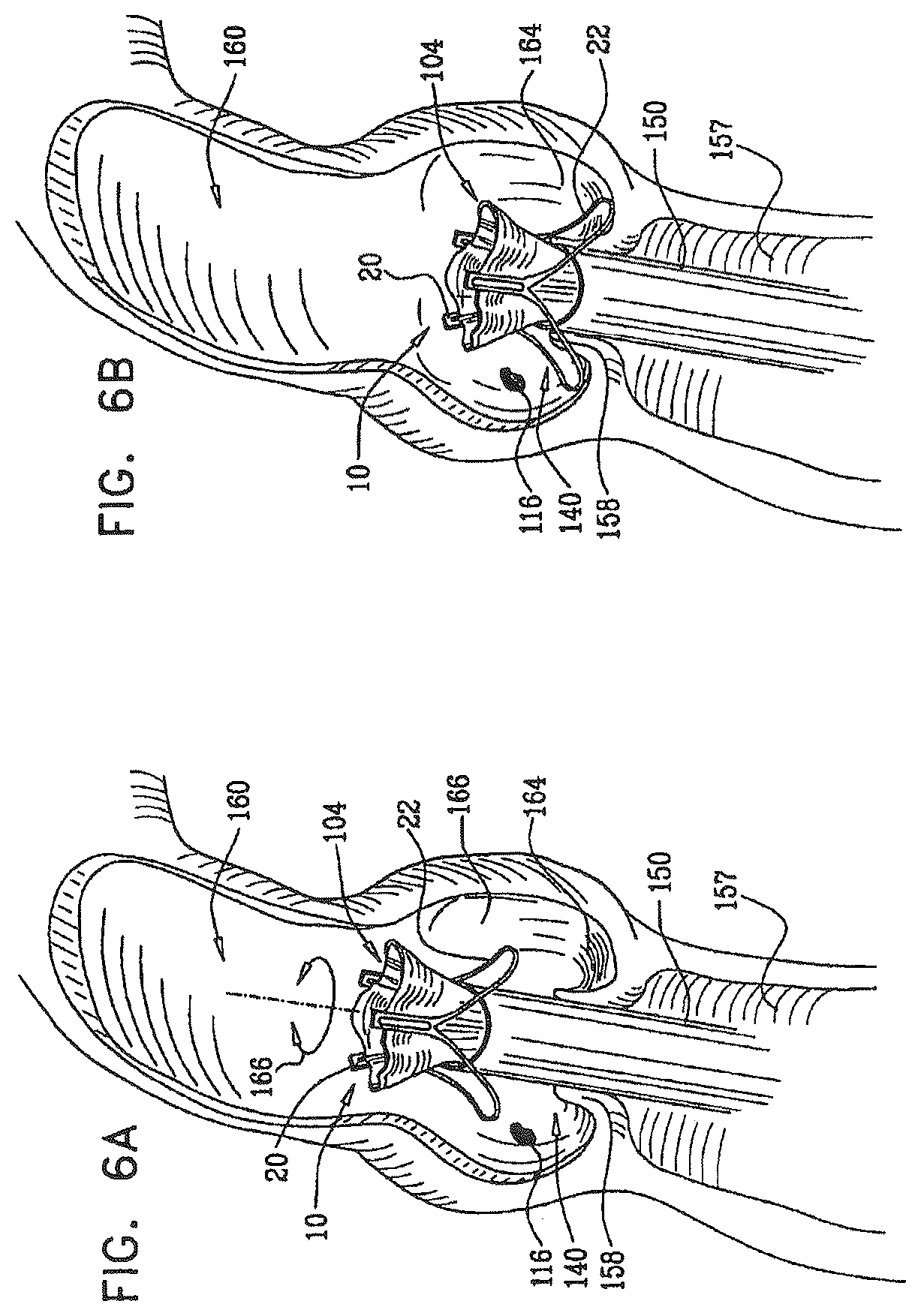 Patent US12396849 Figure 8 – Sinus-engaging valve fixation member