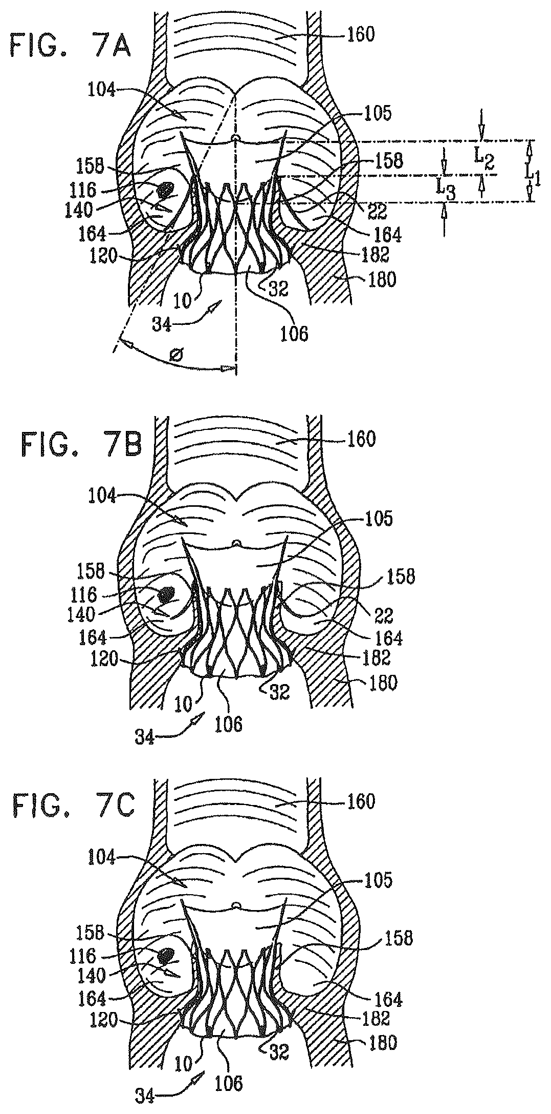 Patent US12396849 Figure 9 – Sinus-engaging valve fixation member