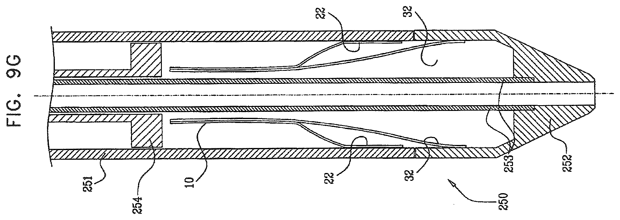 Patent US12396849 Figure 14 – Sinus-engaging valve fixation member