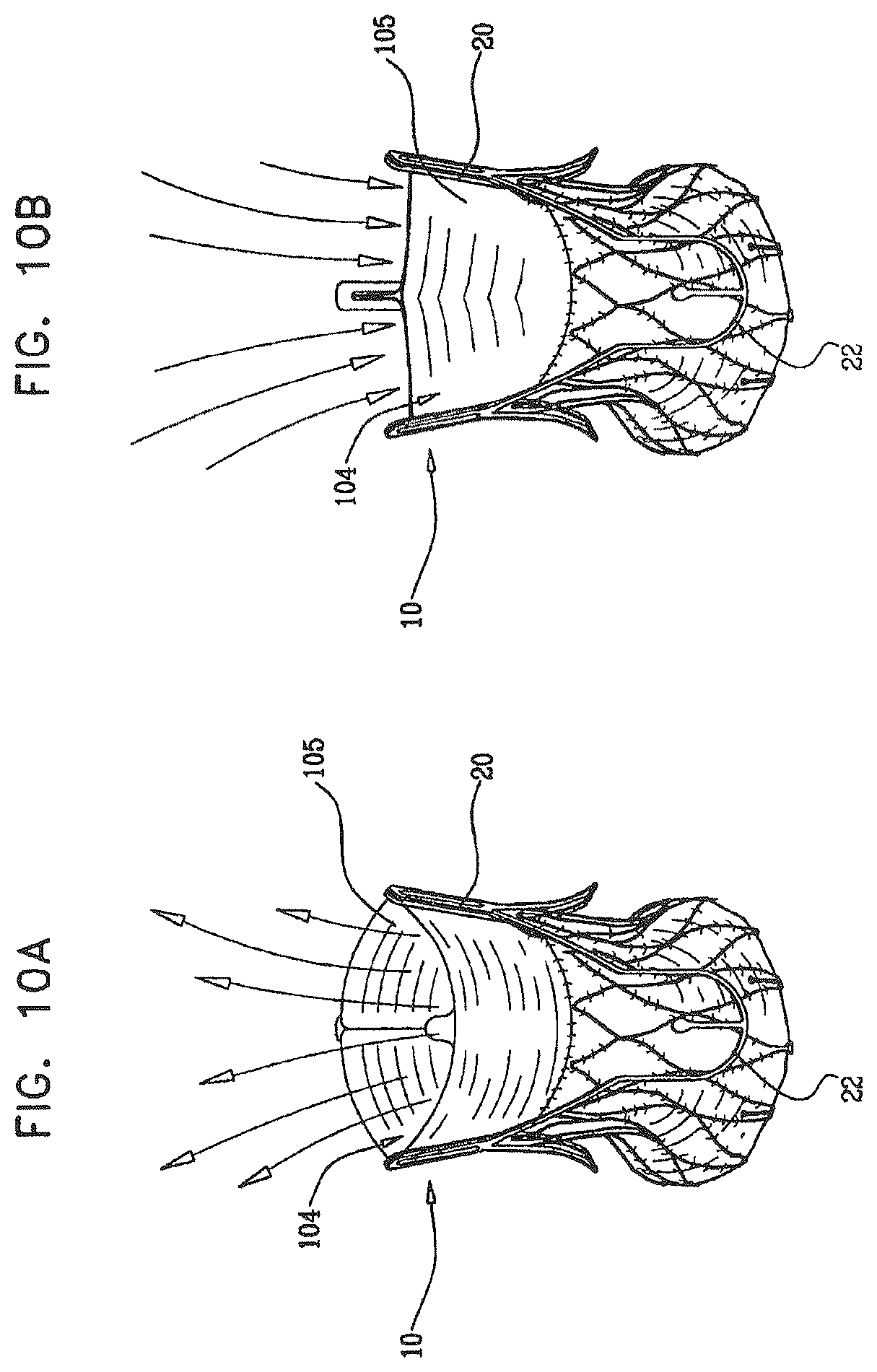 Patent US12396849 Figure 15 – Sinus-engaging valve fixation member