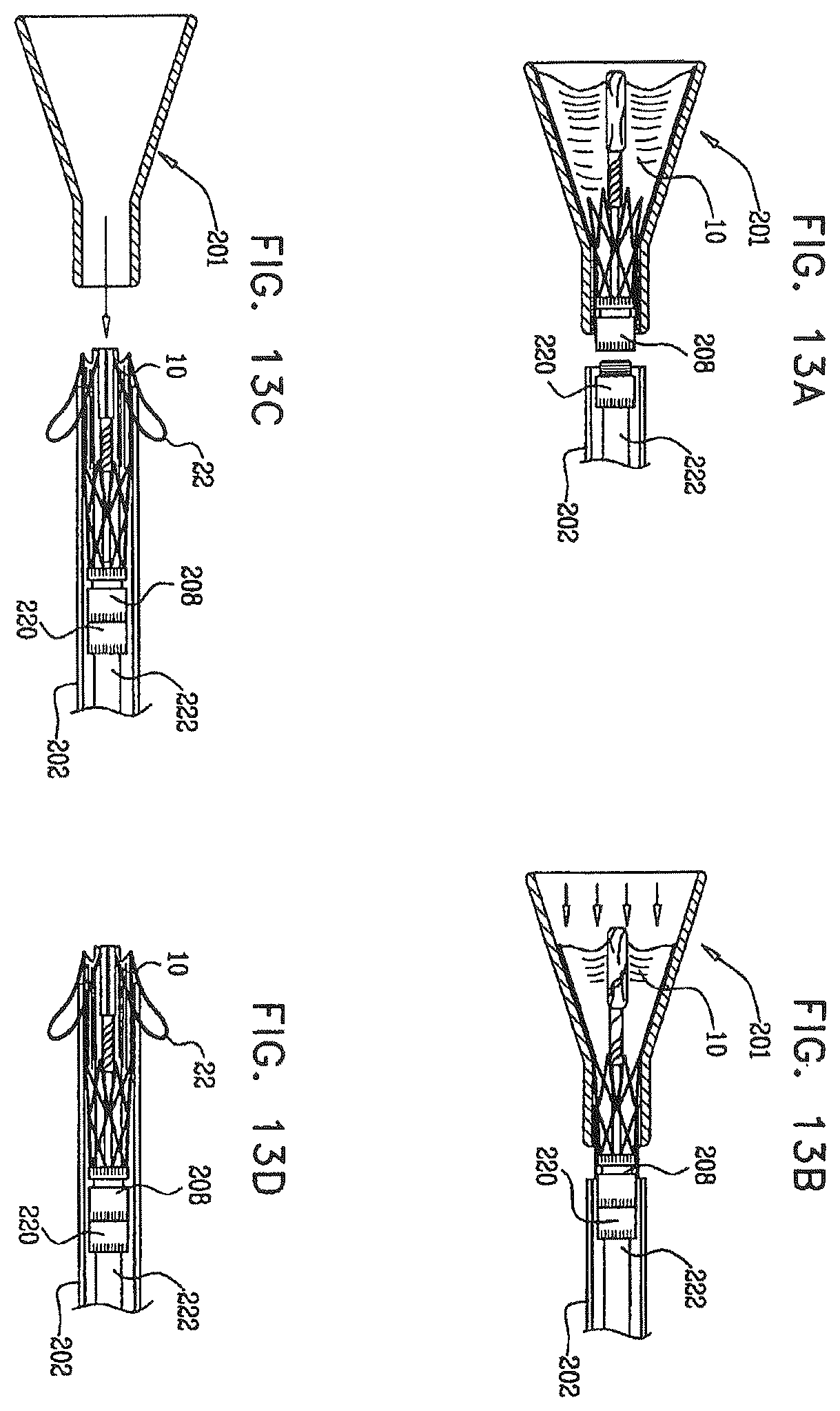 Patent US12396849 Figure 19 – Sinus-engaging valve fixation member