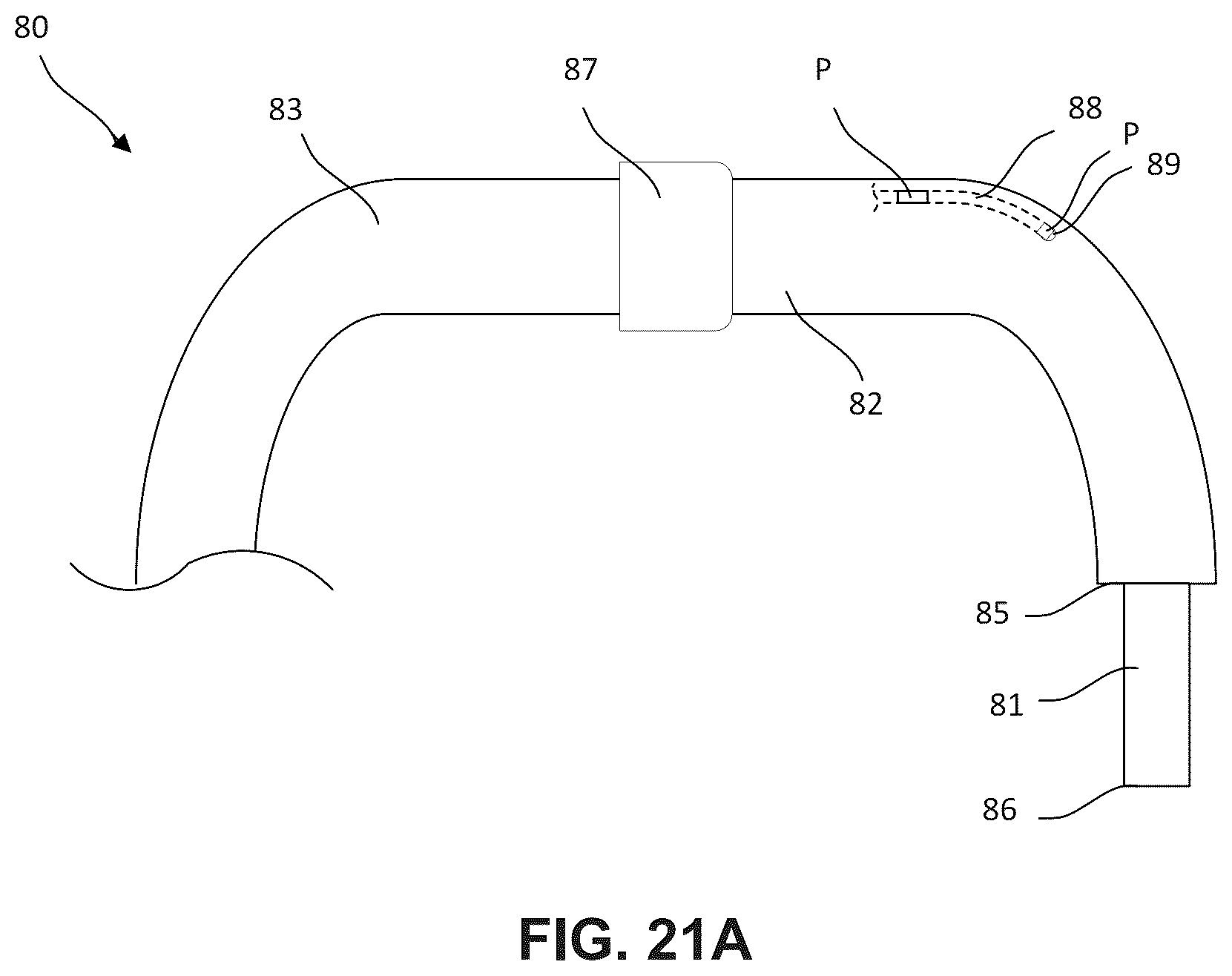 Patent US12396850 Figure 16 – Catheterization method and apparatus