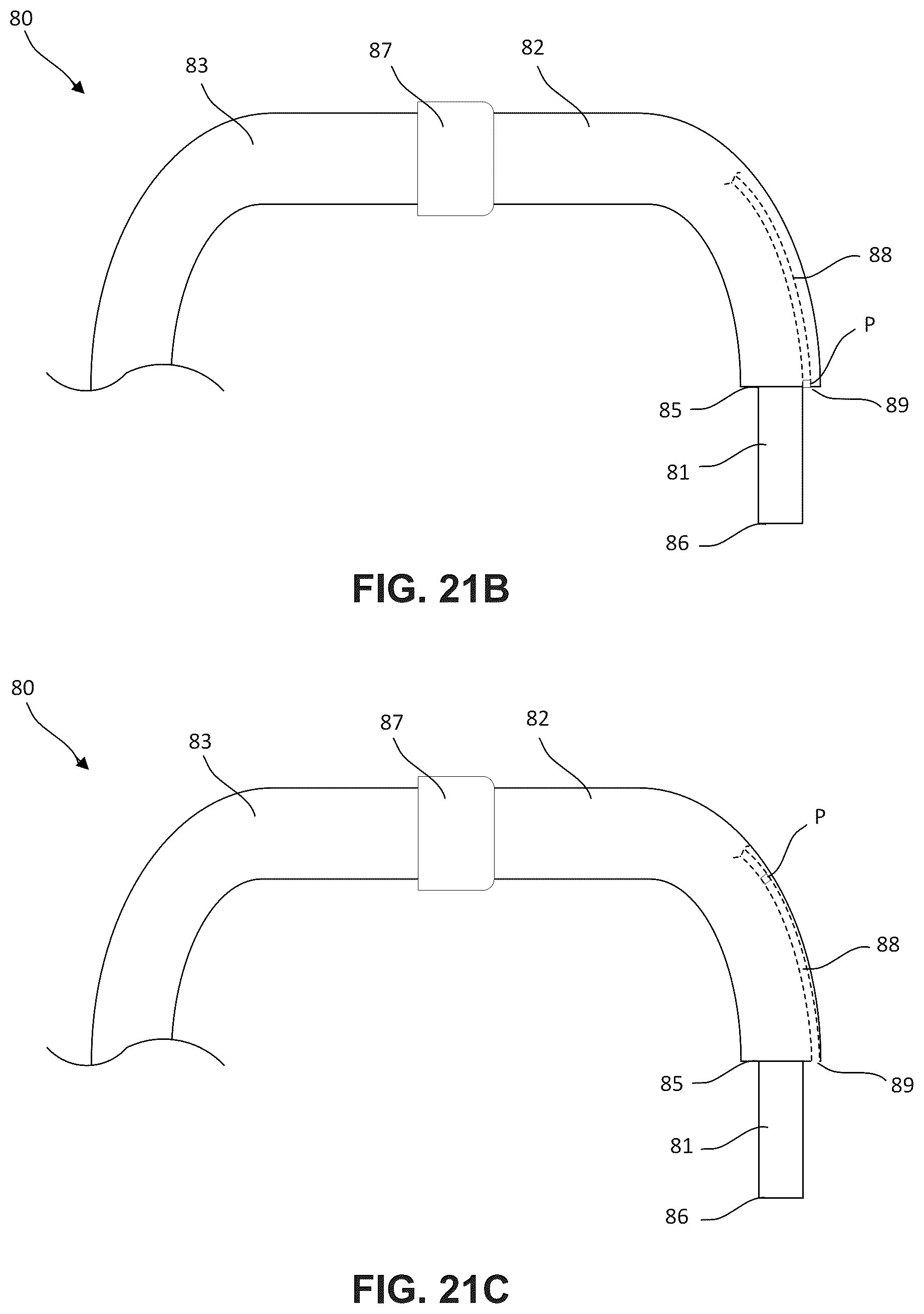 Patent US12396850 Figure 17 – Catheterization method and apparatus