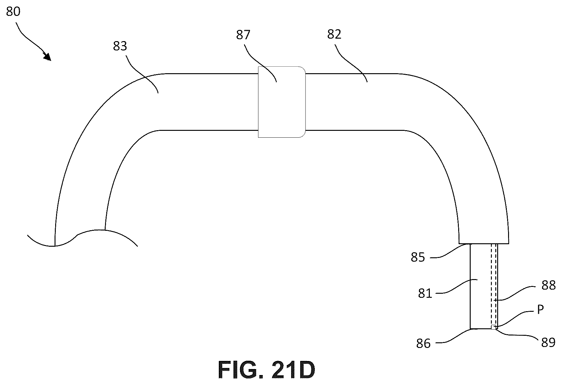 Patent US12396850 Figure 18 – Catheterization method and apparatus