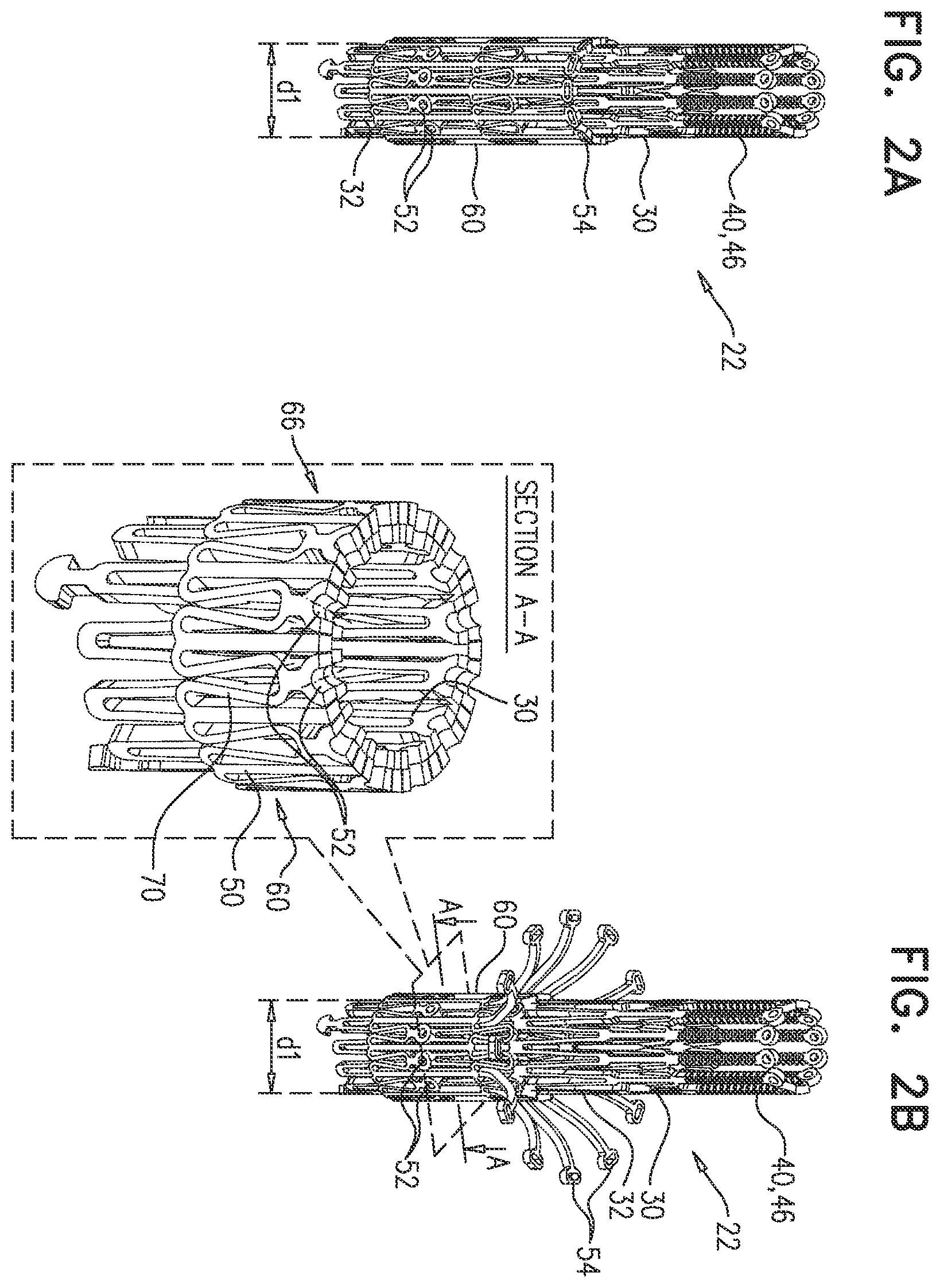 Patent US12396851 Figure 2 – Prosthetic valve with arms and flanges