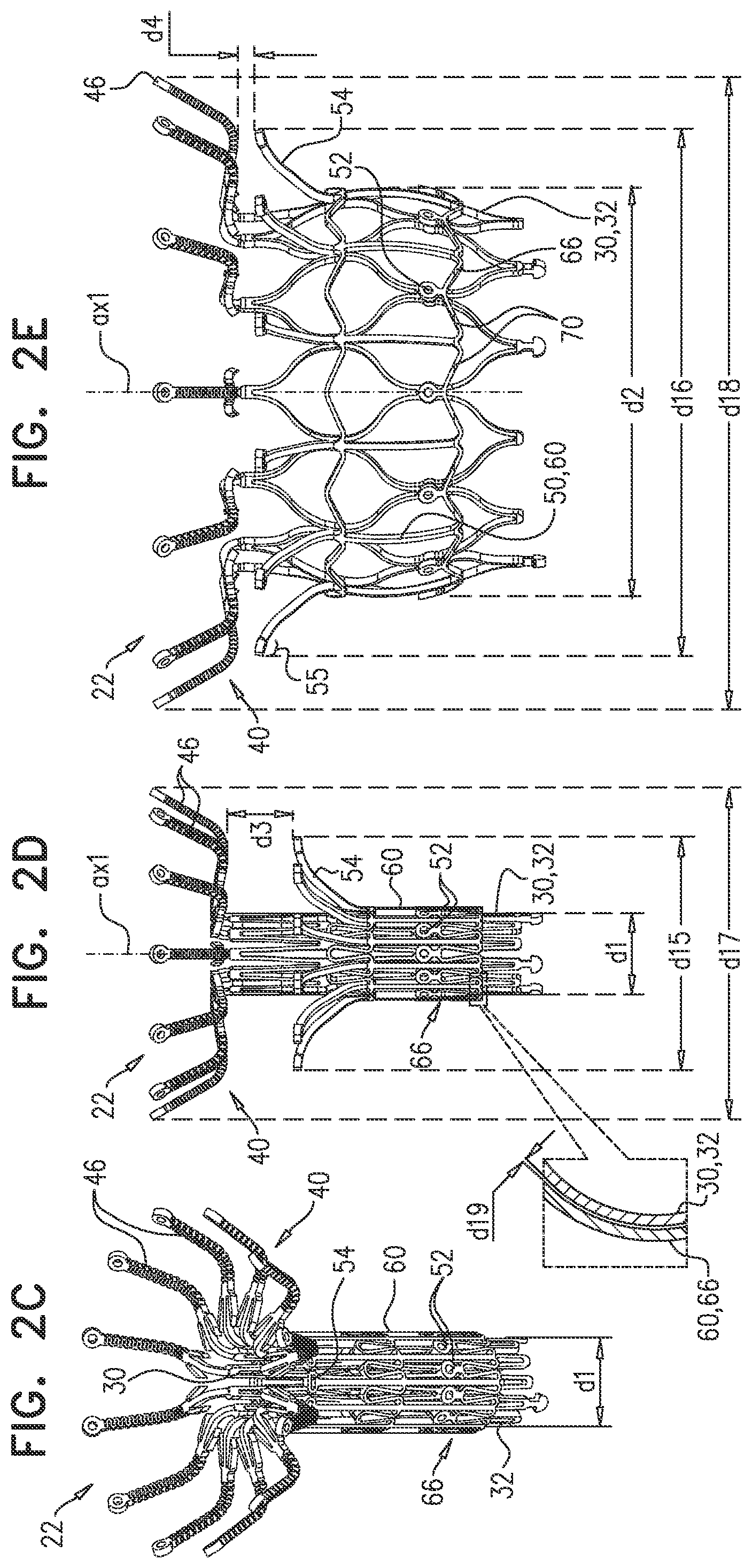 Patent US12396851 Figure 3 – Prosthetic valve with arms and flanges