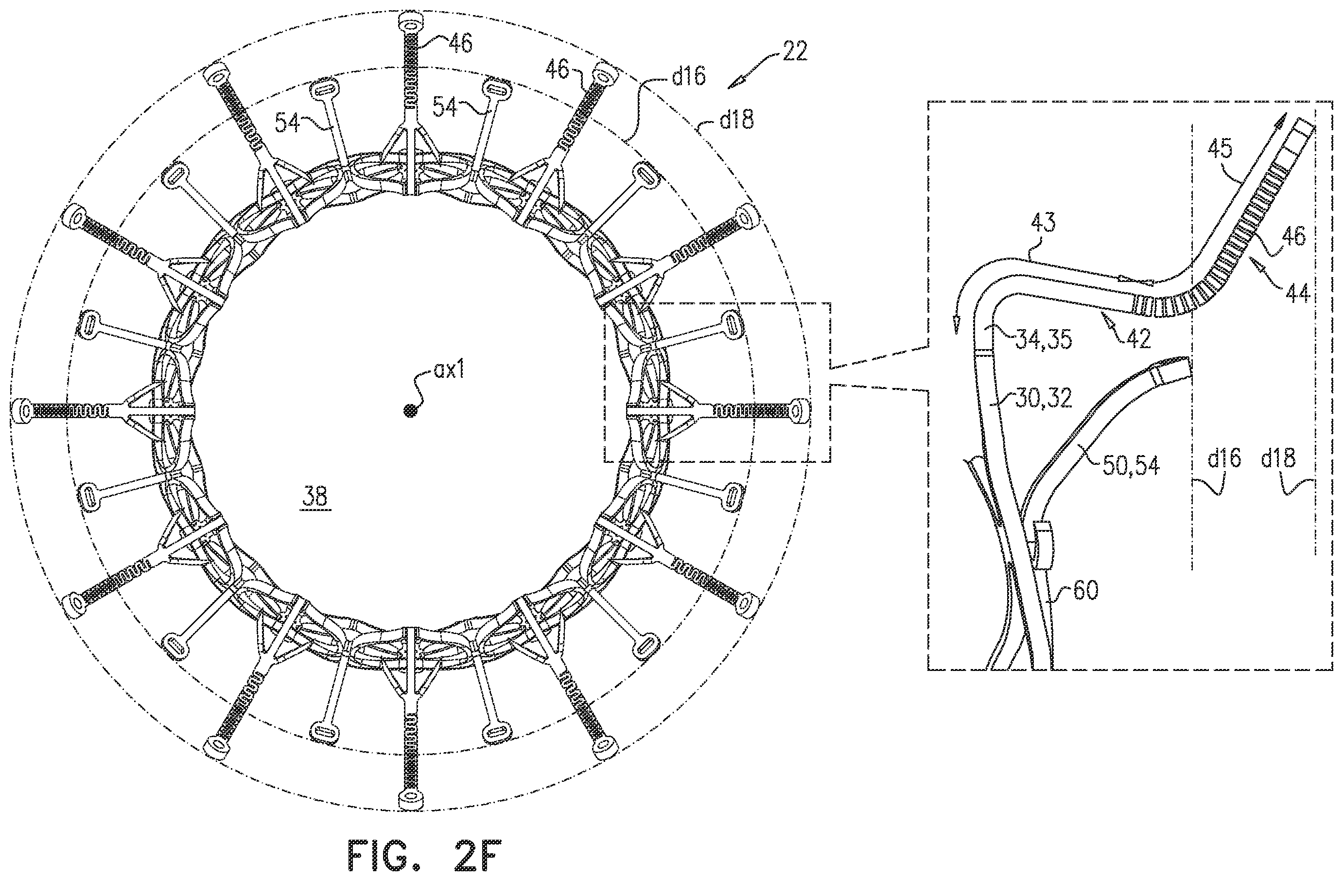 Patent US12396851 Figure 4 – Prosthetic valve with arms and flanges