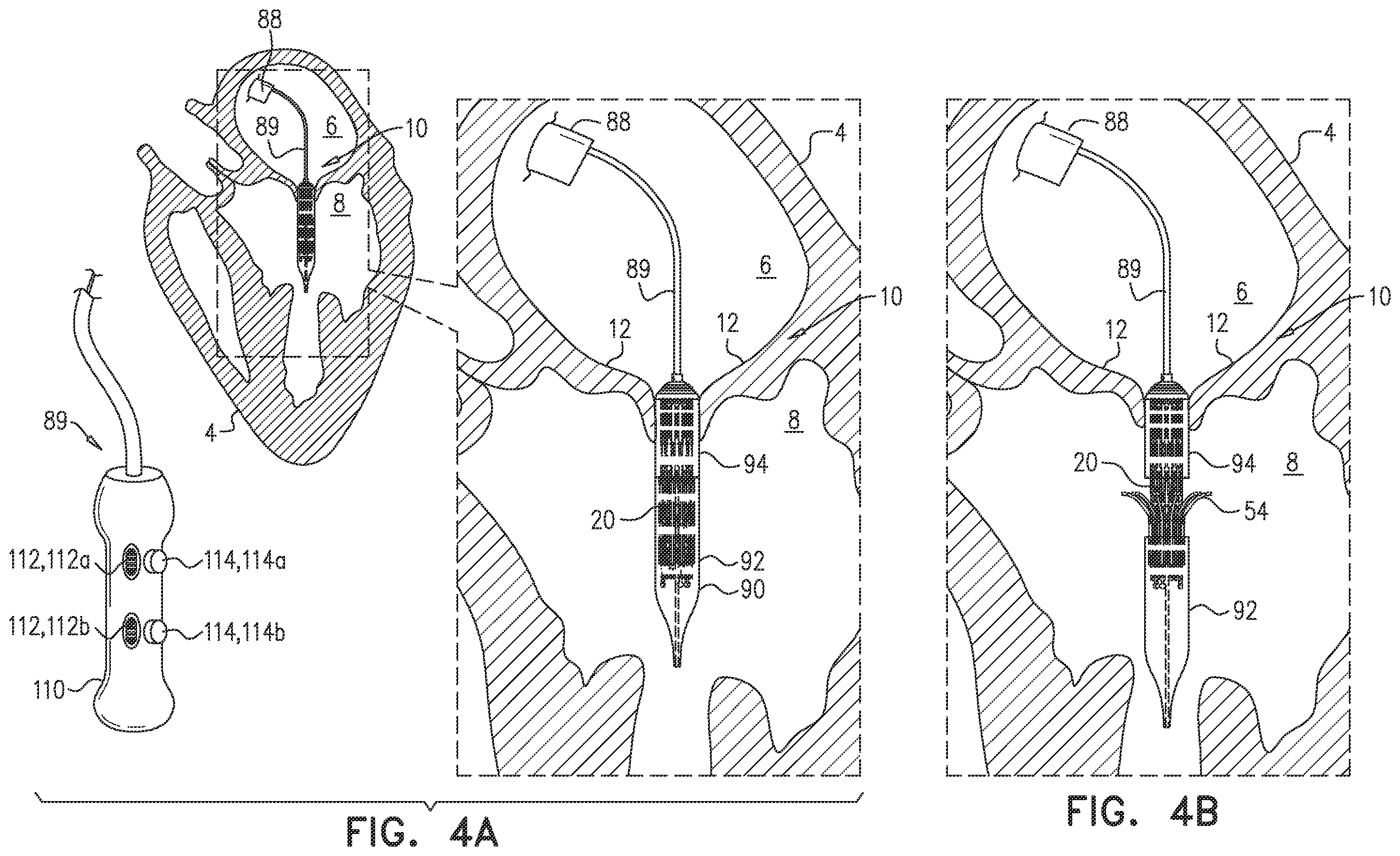 Patent US12396851 Figure 9 – Prosthetic valve with arms and flanges