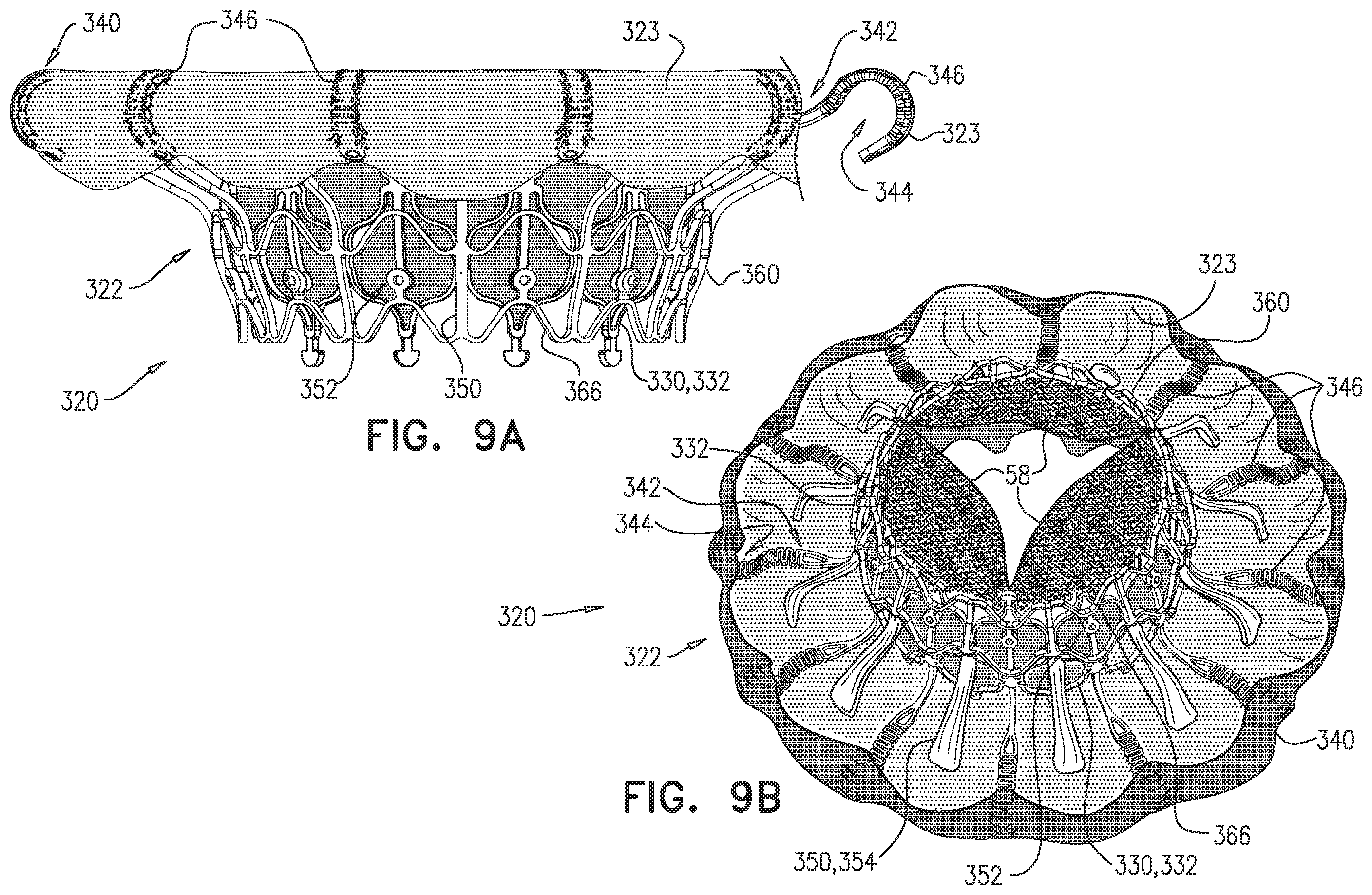 Patent US12396851 Figure 16 – Prosthetic valve with arms and flanges