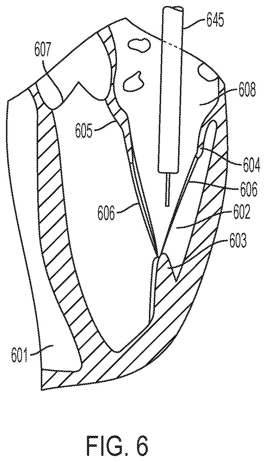 Patent US12396853 Figure 6 – Systems and methods for delivery of chordae replacement system