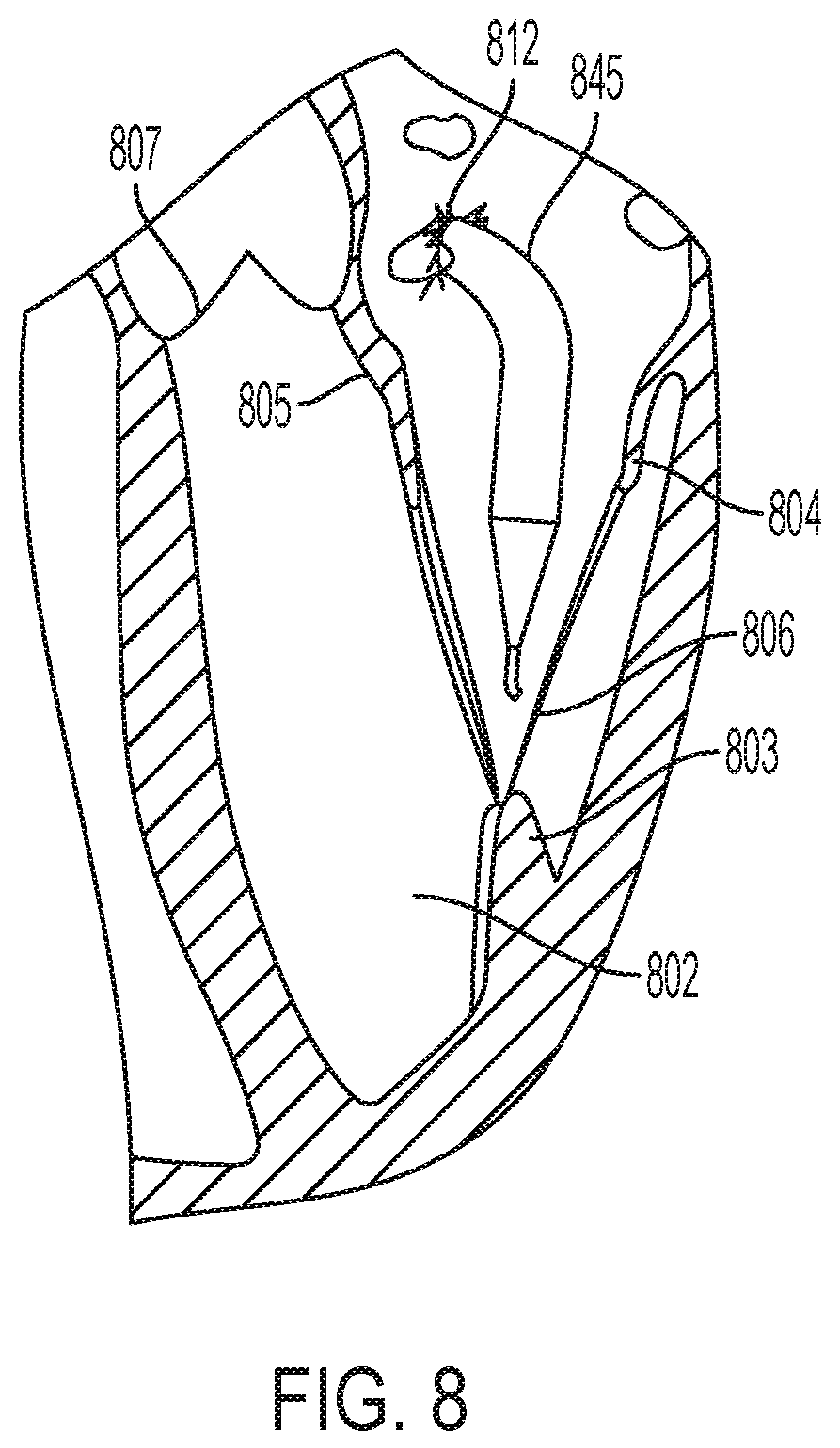 Patent US12396853 Figure 8 – Systems and methods for delivery of chordae replacement system