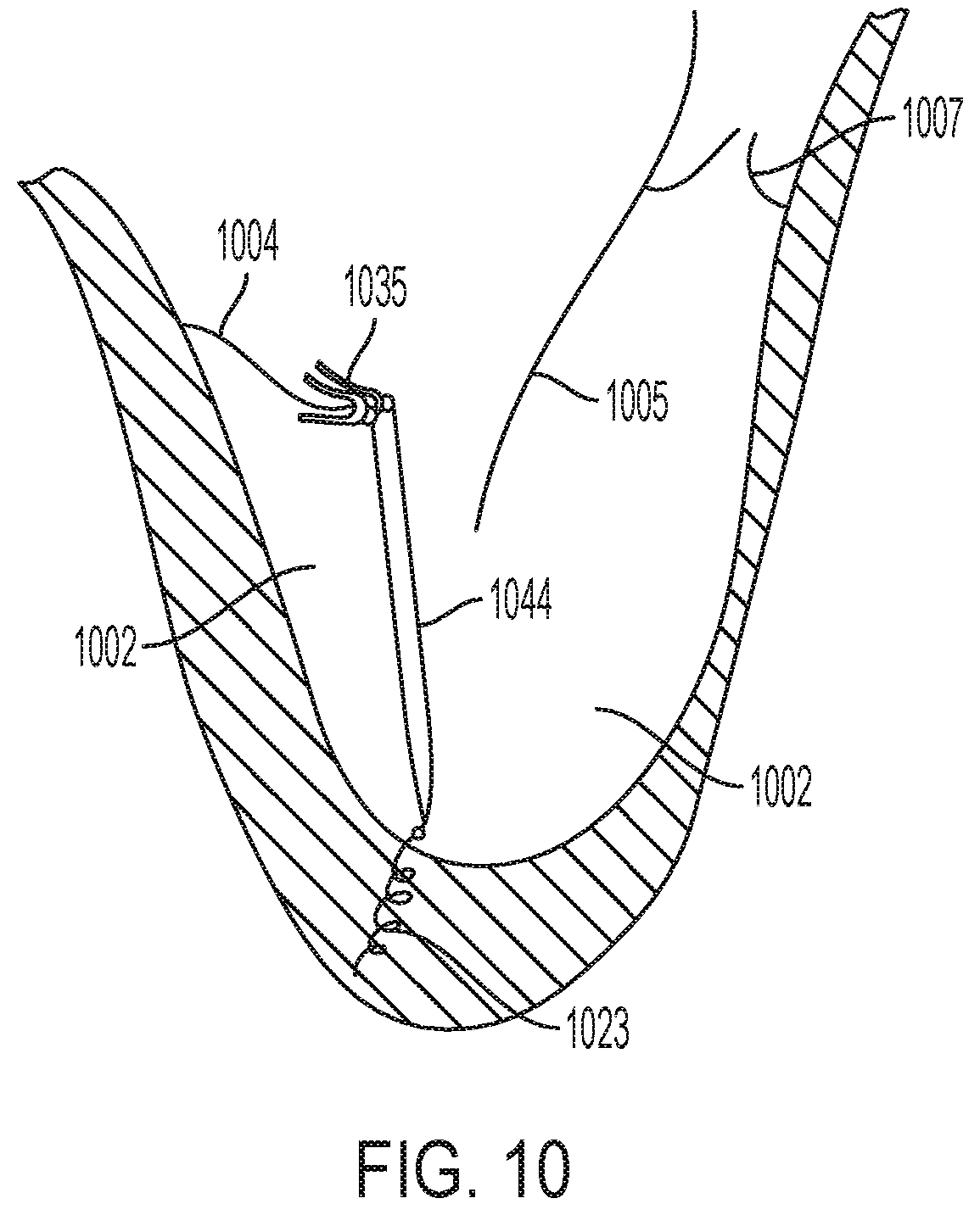 Patent US12396853 Figure 10 – Systems and methods for delivery of chordae replacement system
