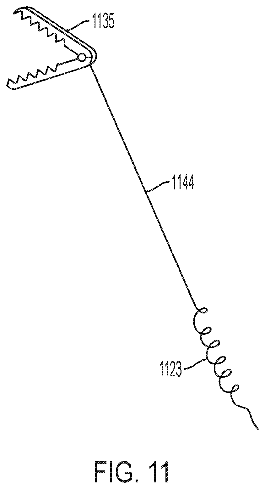 Patent US12396853 Figure 11 – Systems and methods for delivery of chordae replacement system