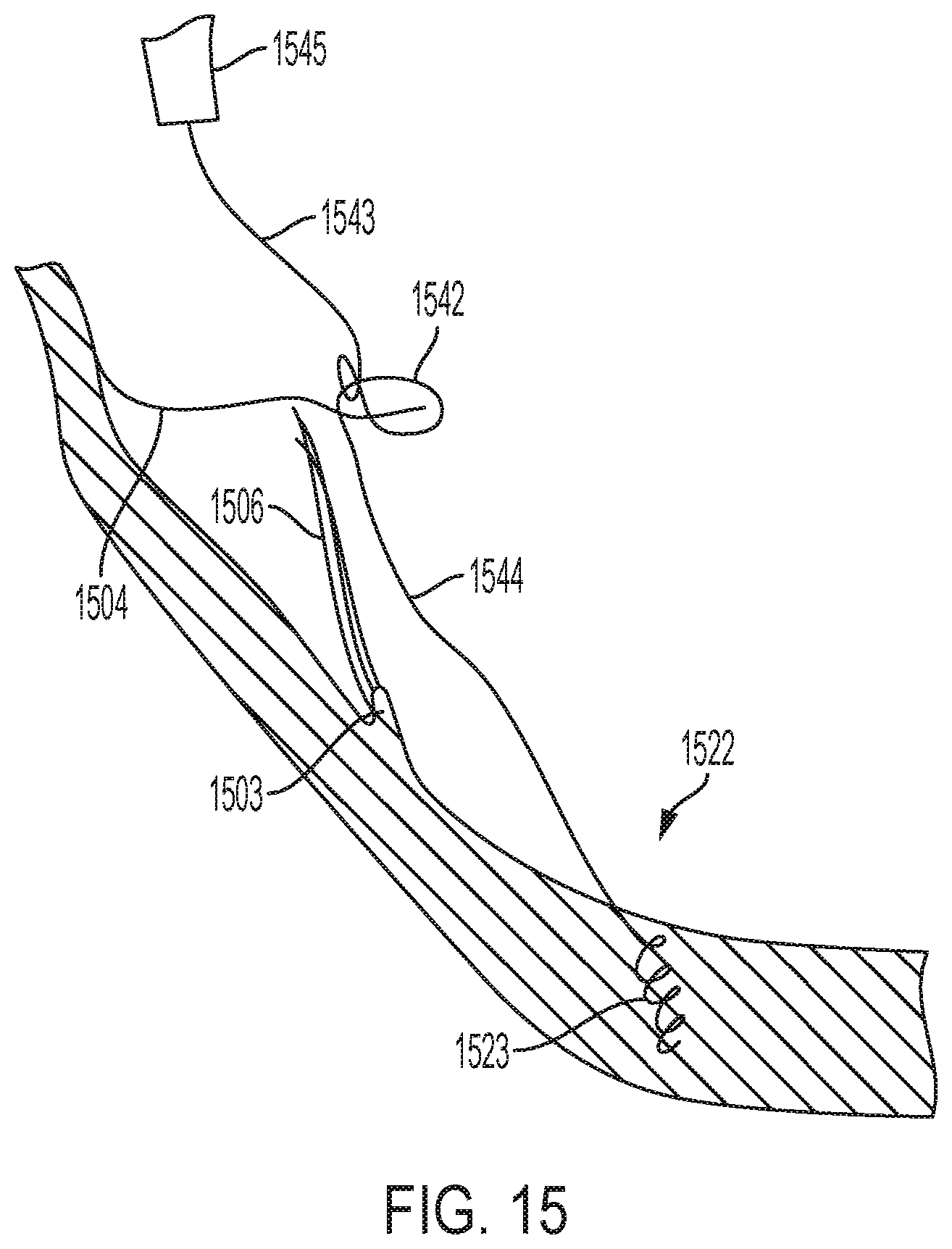 Patent US12396853 Figure 15 – Systems and methods for delivery of chordae replacement system