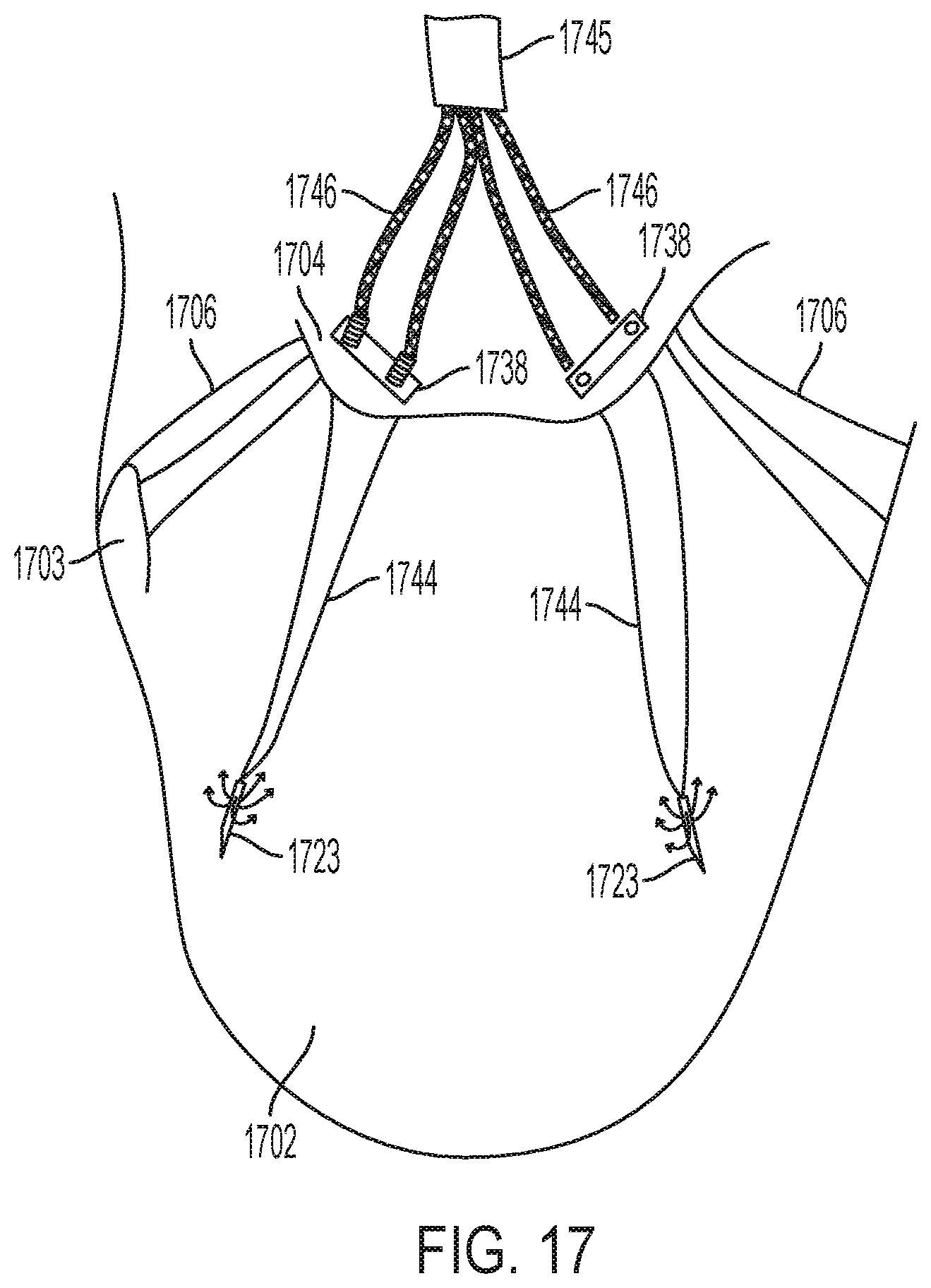 Patent US12396853 Figure 17 – Systems and methods for delivery of chordae replacement system