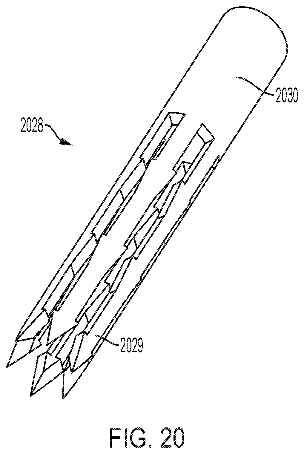 Patent US12396853 Figure 20 – Systems and methods for delivery of chordae replacement system