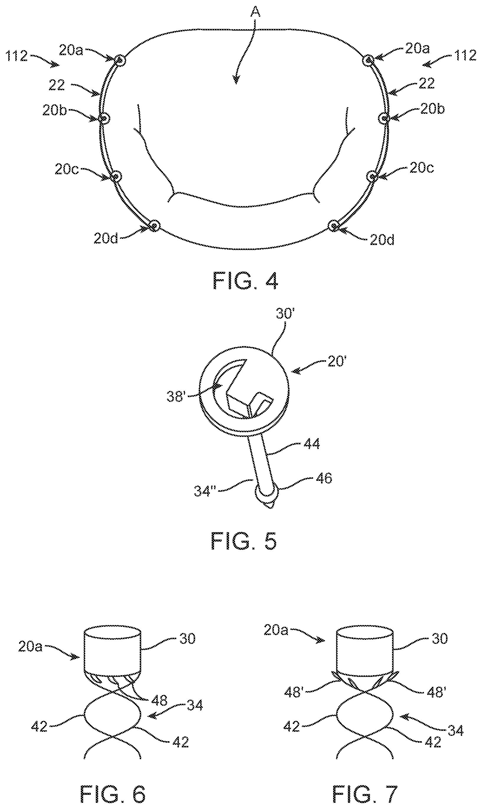 Patent US12396854 Figure 5 – Systems, devices and methods for reshaping a bodily lumen