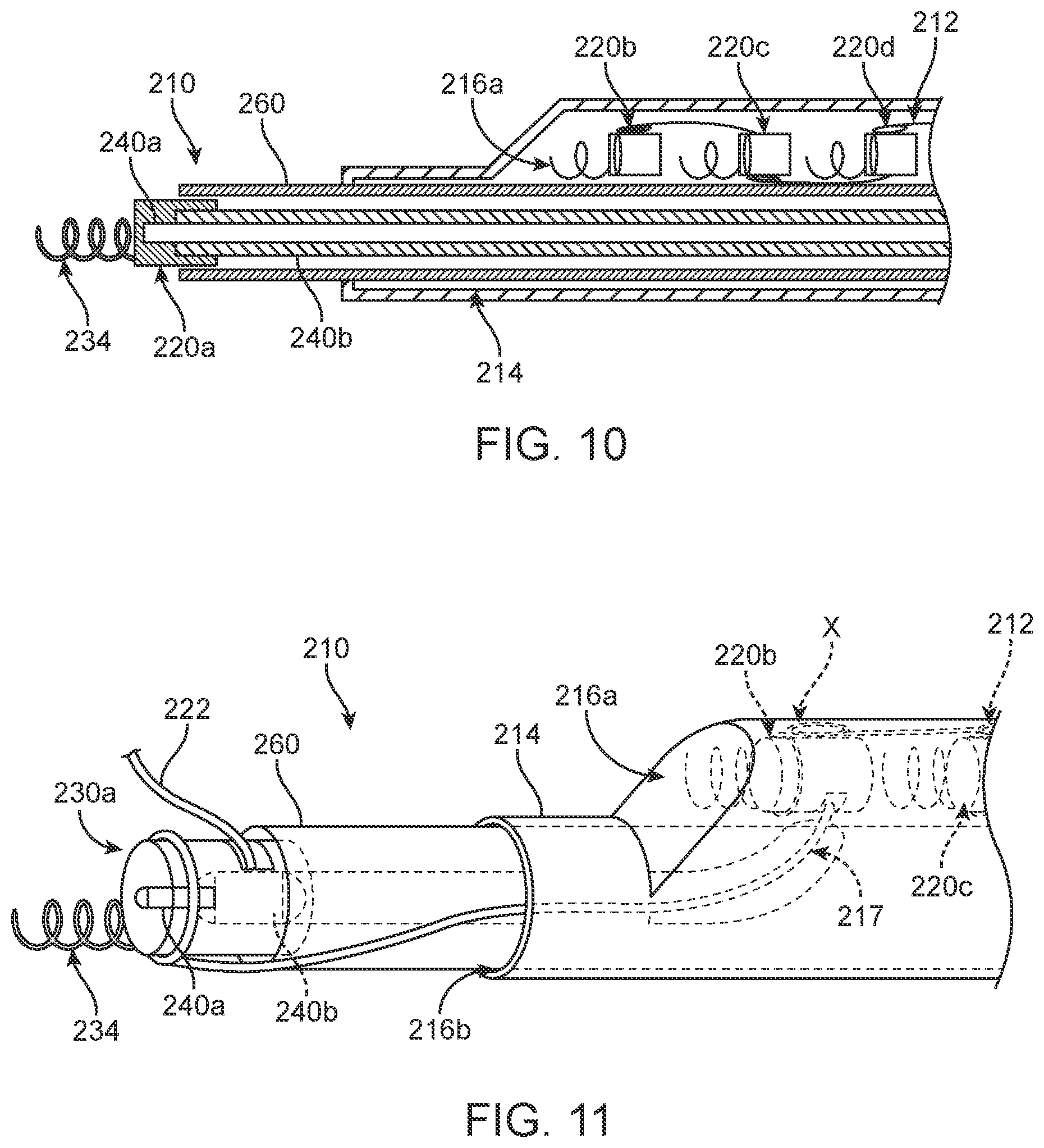 Patent US12396854 Figure 8 – Systems, devices and methods for reshaping a bodily lumen