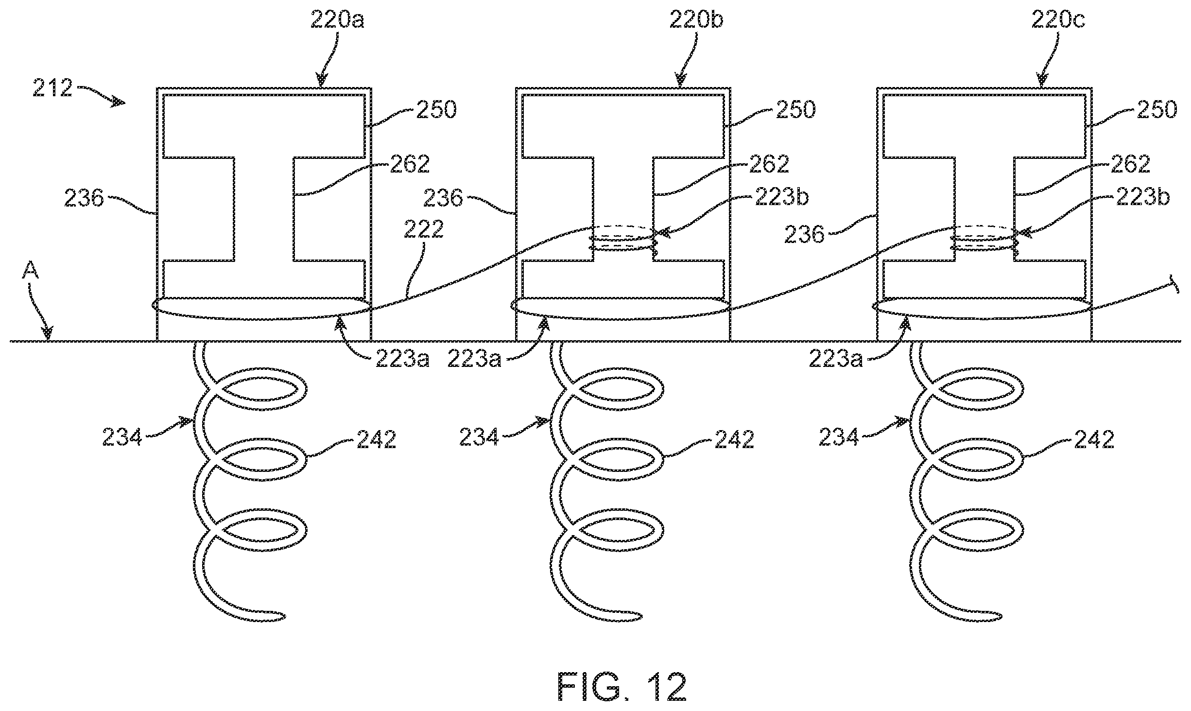 Patent US12396854 Figure 9 – Systems, devices and methods for reshaping a bodily lumen