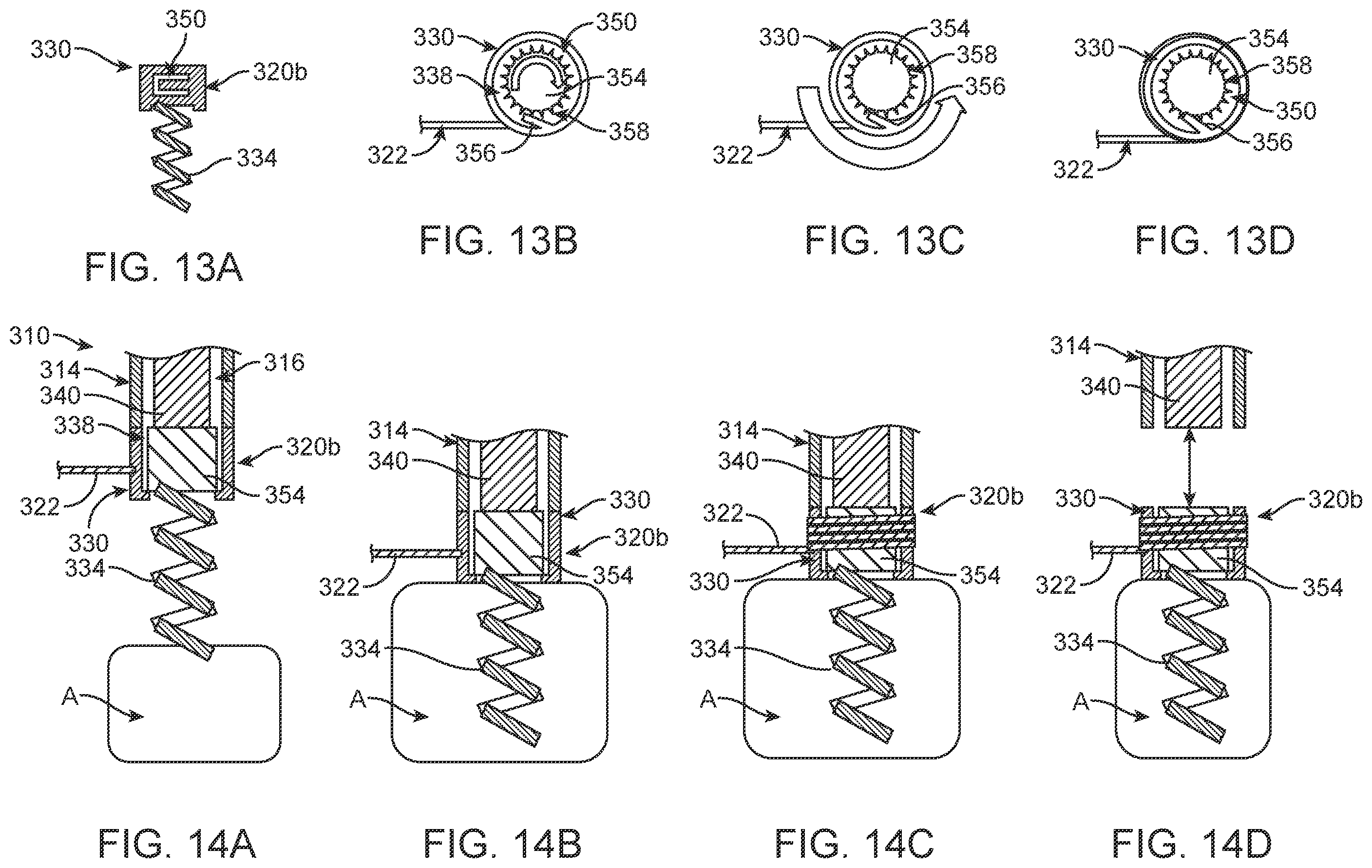 Patent US12396854 Figure 10 – Systems, devices and methods for reshaping a bodily lumen