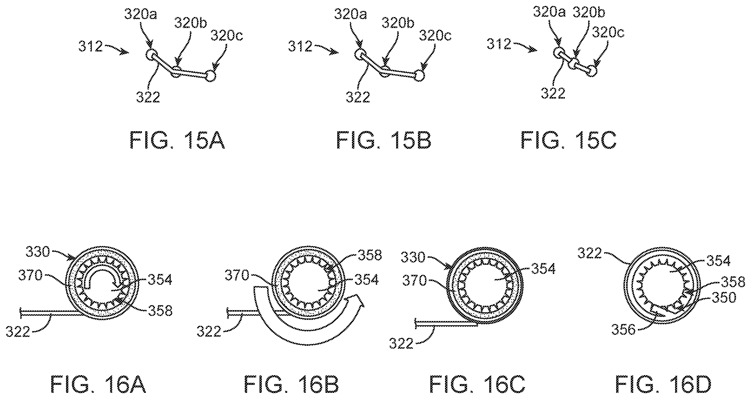 Patent US12396854 Figure 11 – Systems, devices and methods for reshaping a bodily lumen