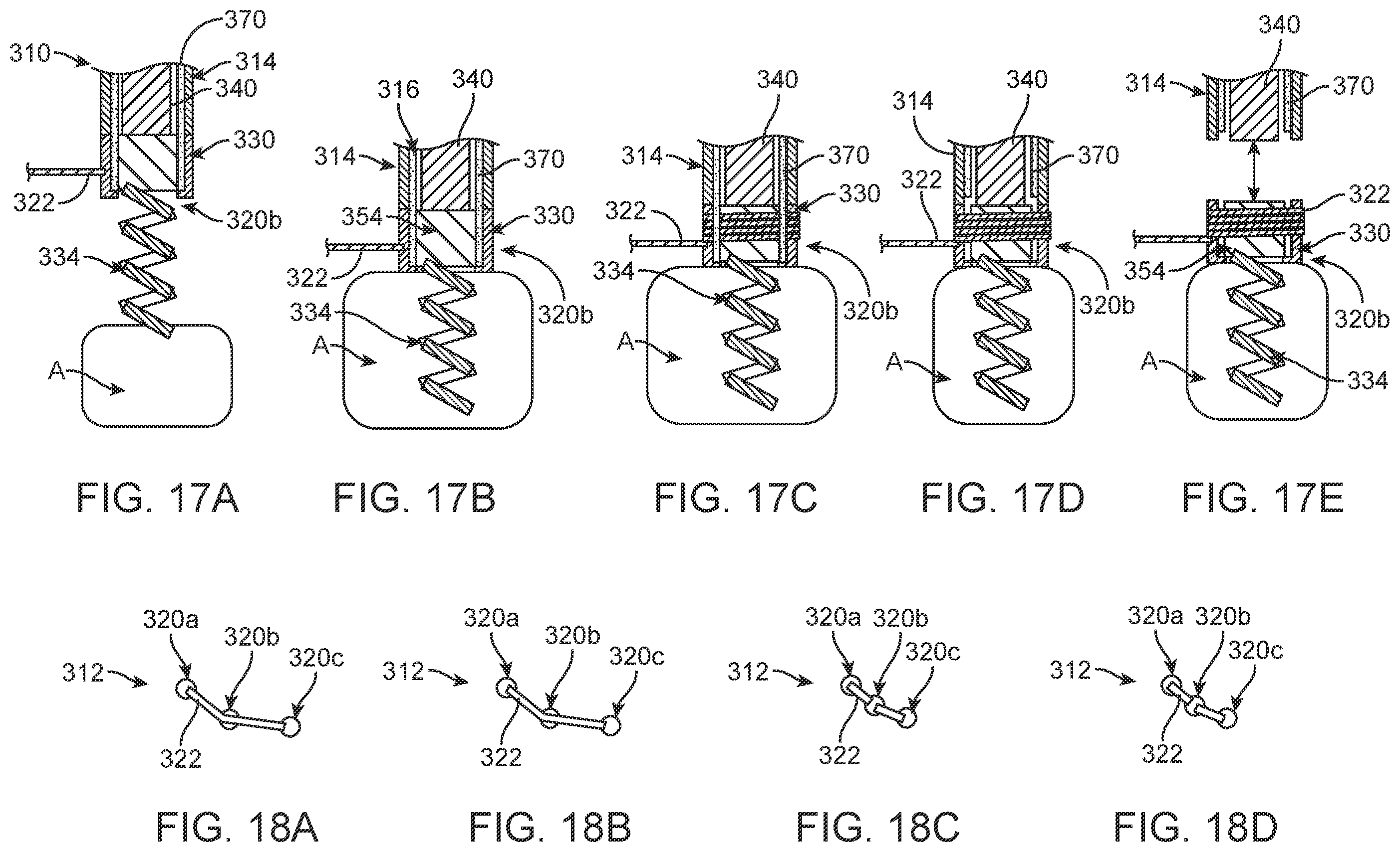 Patent US12396854 Figure 12 – Systems, devices and methods for reshaping a bodily lumen