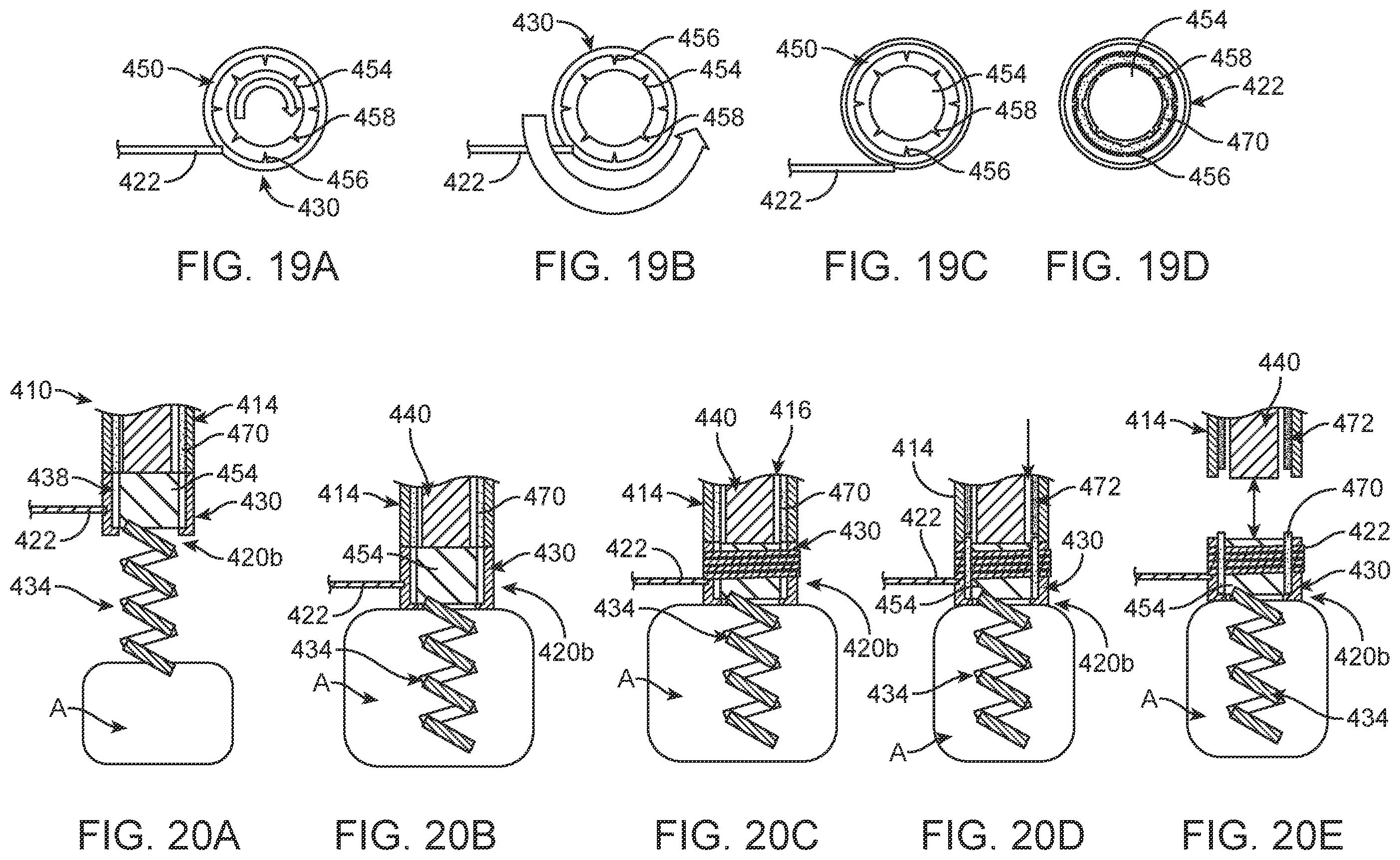 Patent US12396854 Figure 13 – Systems, devices and methods for reshaping a bodily lumen