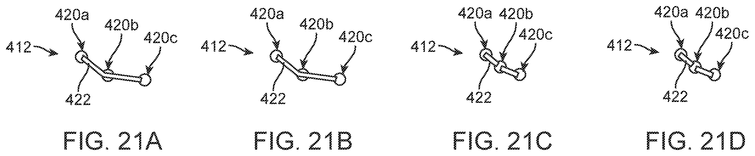 Patent US12396854 Figure 14 – Systems, devices and methods for reshaping a bodily lumen