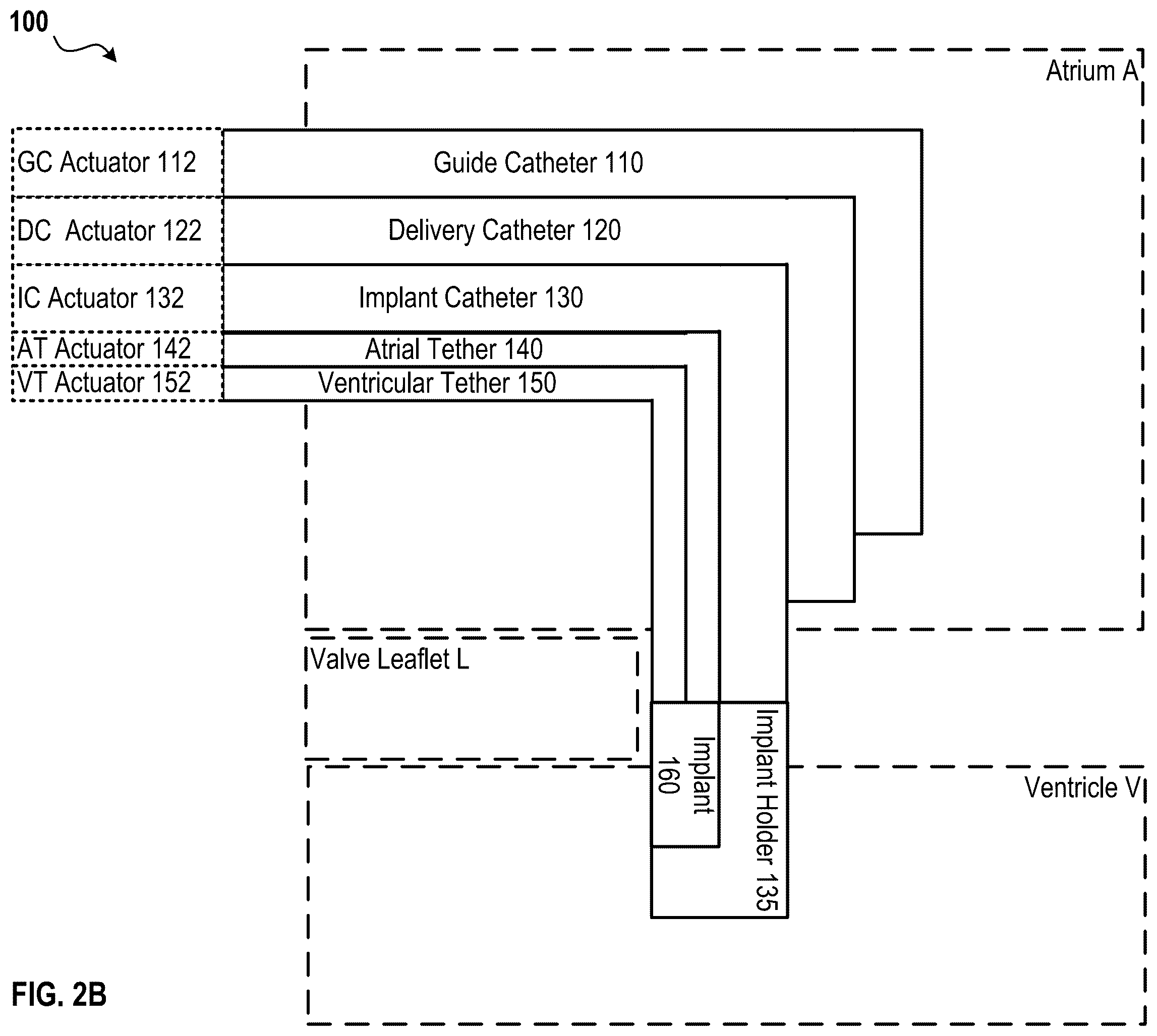 Patent US12396855 Figure 4 – Systems, devices, and methods for reducing heart valve regurgitation