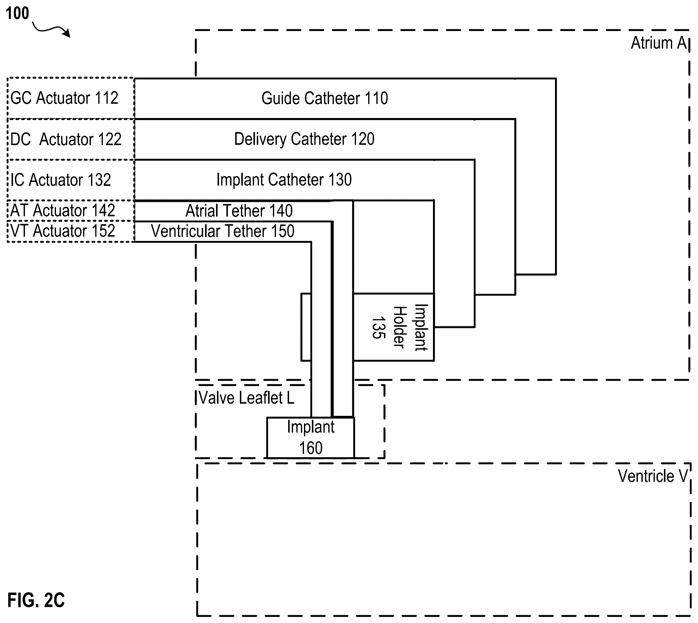 Patent US12396855 Figure 5 – Systems, devices, and methods for reducing heart valve regurgitation