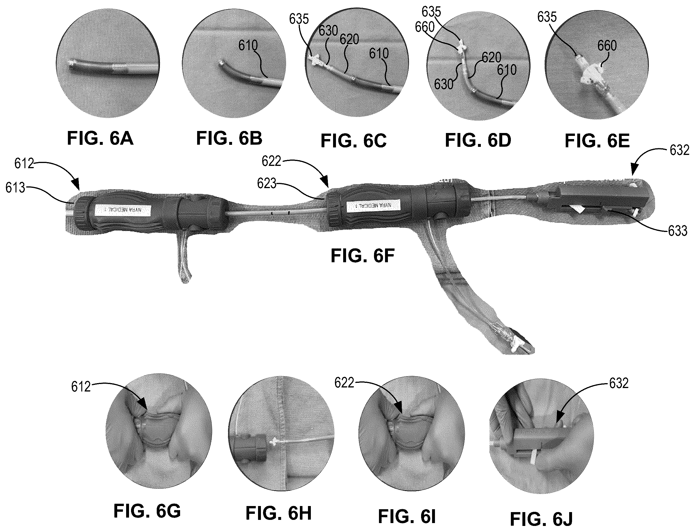 Patent US12396855 Figure 9 – Systems, devices, and methods for reducing heart valve regurgitation