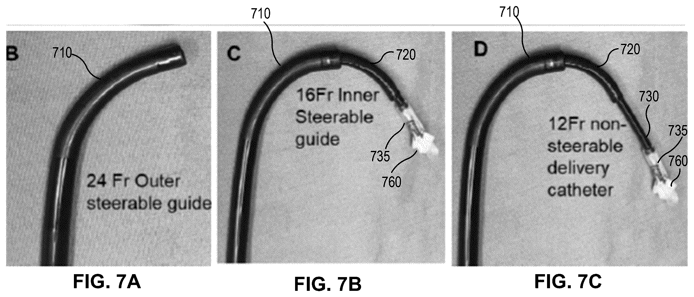Patent US12396855 Figure 10 – Systems, devices, and methods for reducing heart valve regurgitation