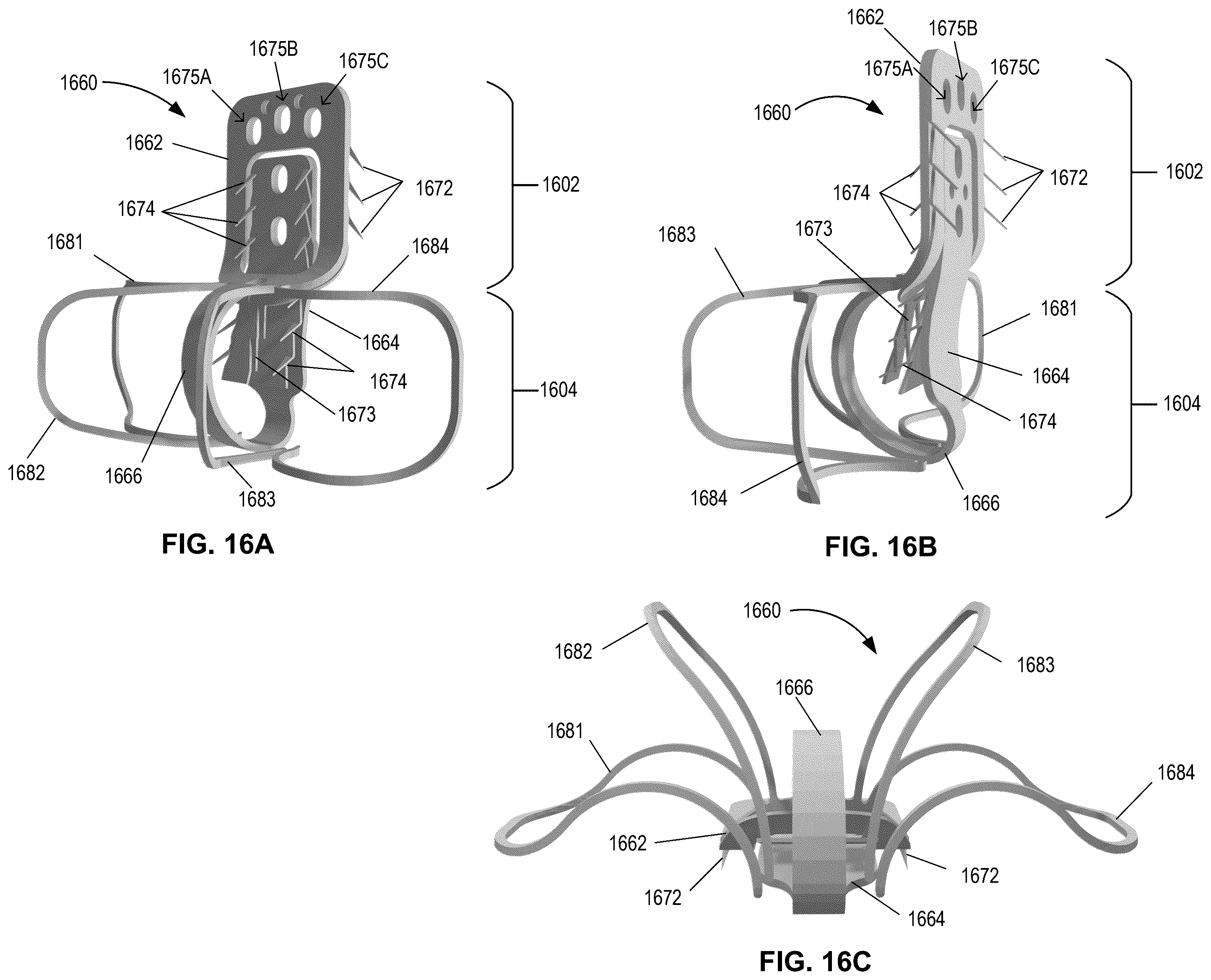 Patent US12396855 Figure 15 – Systems, devices, and methods for reducing heart valve regurgitation