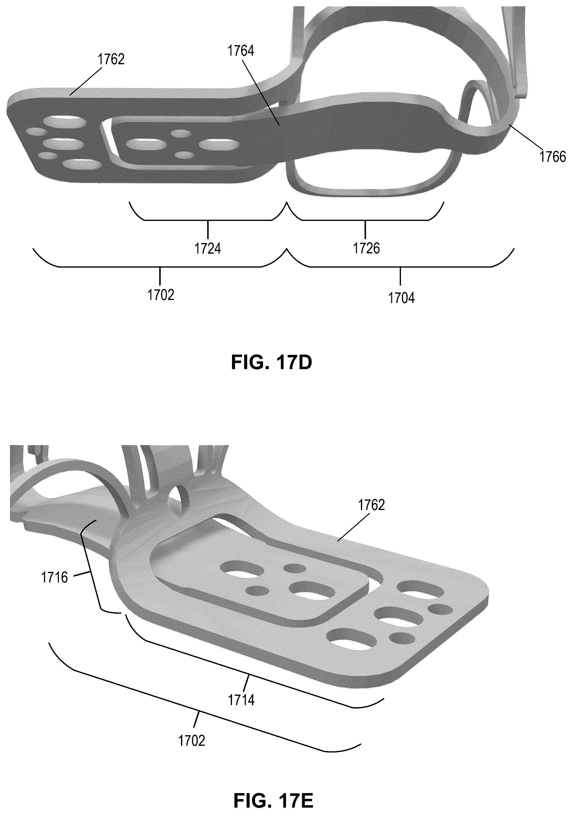 Patent US12396855 Figure 17 – Systems, devices, and methods for reducing heart valve regurgitation