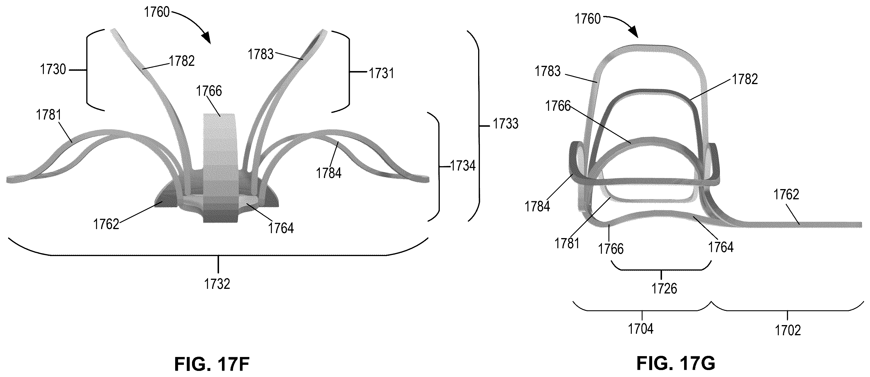Patent US12396855 Figure 18 – Systems, devices, and methods for reducing heart valve regurgitation